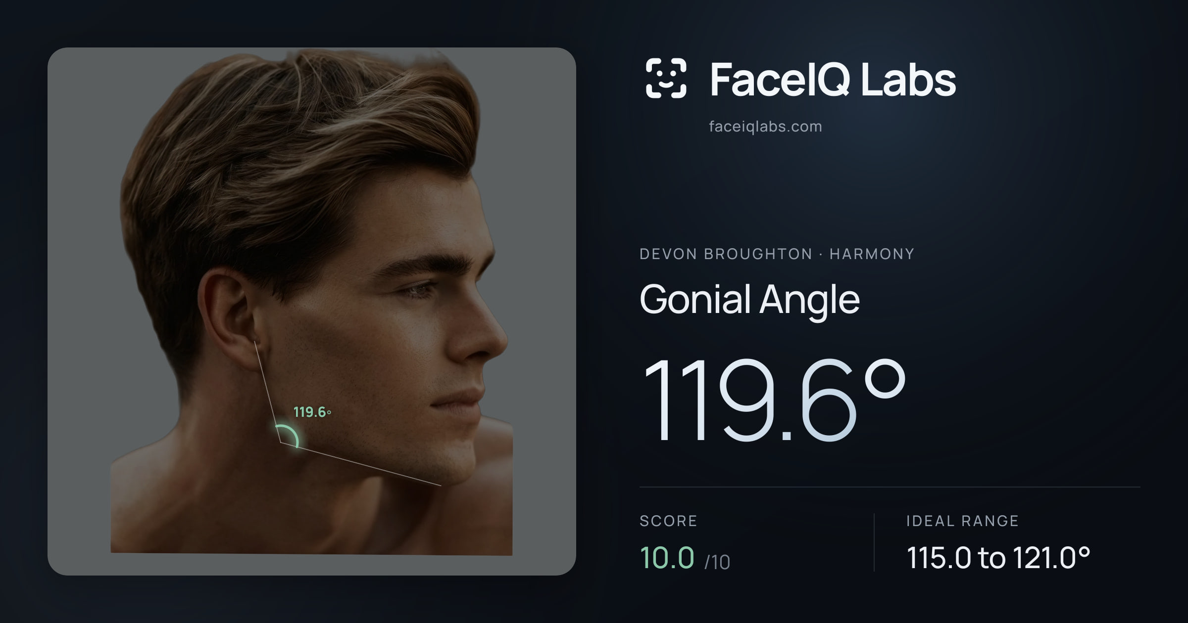 Devon Broughton Gonial Angle: 119.6°, drawn on the photo