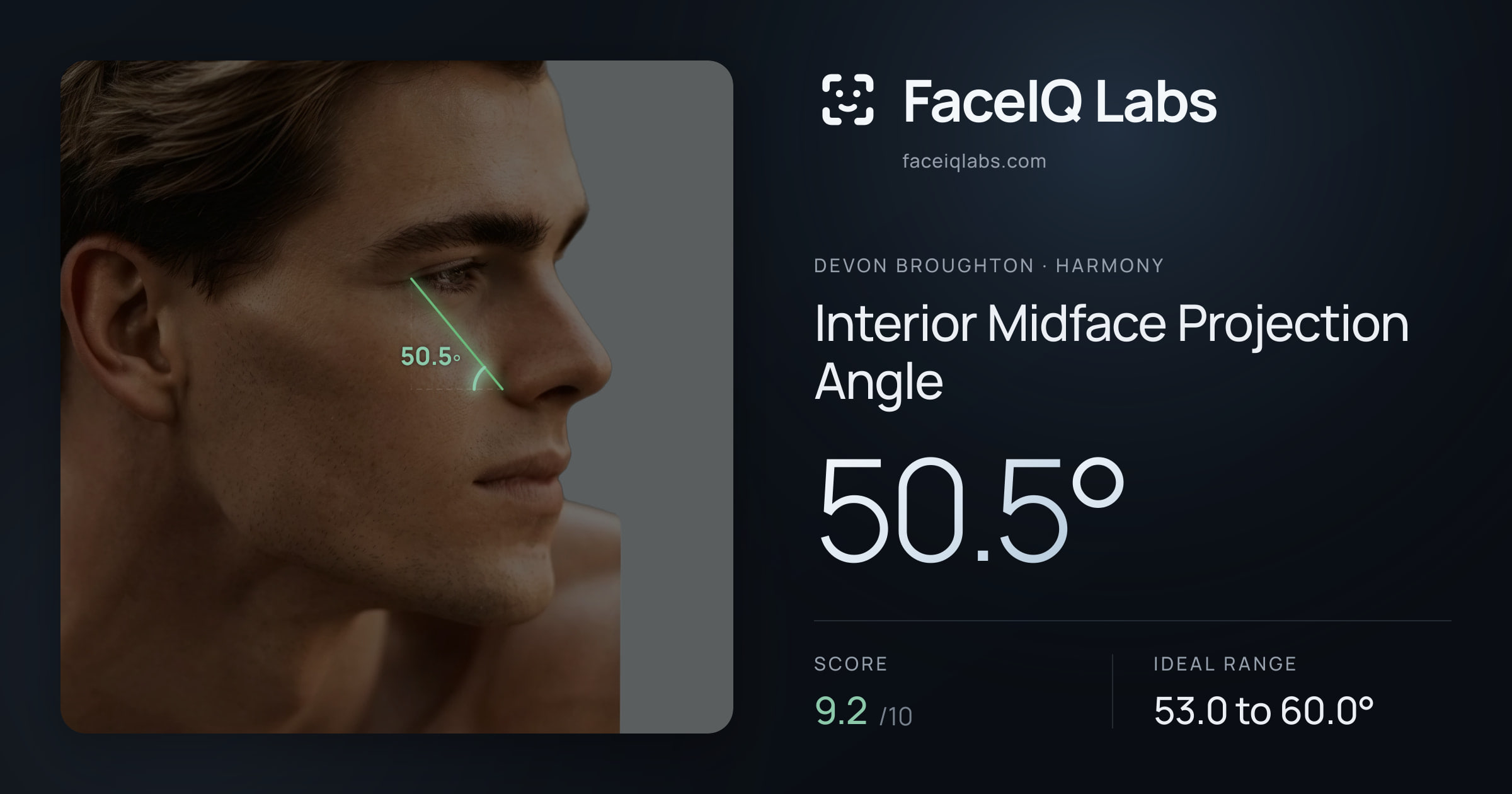 Devon Broughton Interior Midface Projection Angle: 50.5°, drawn on the photo