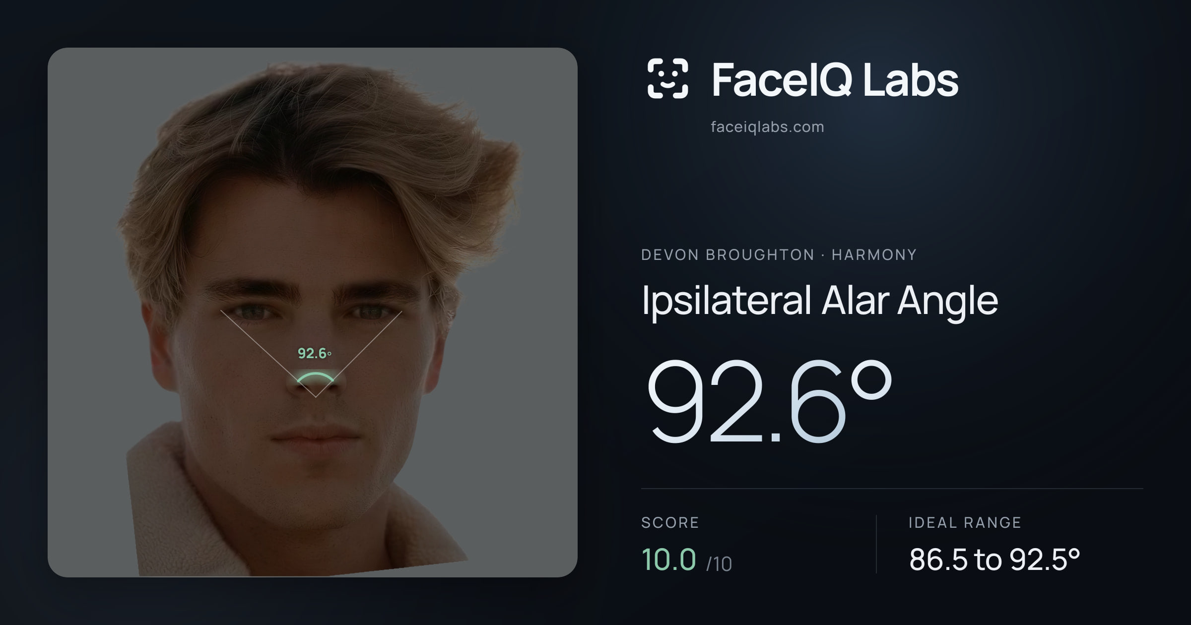 Devon Broughton Ipsilateral Alar Angle: 92.6°, drawn on the photo