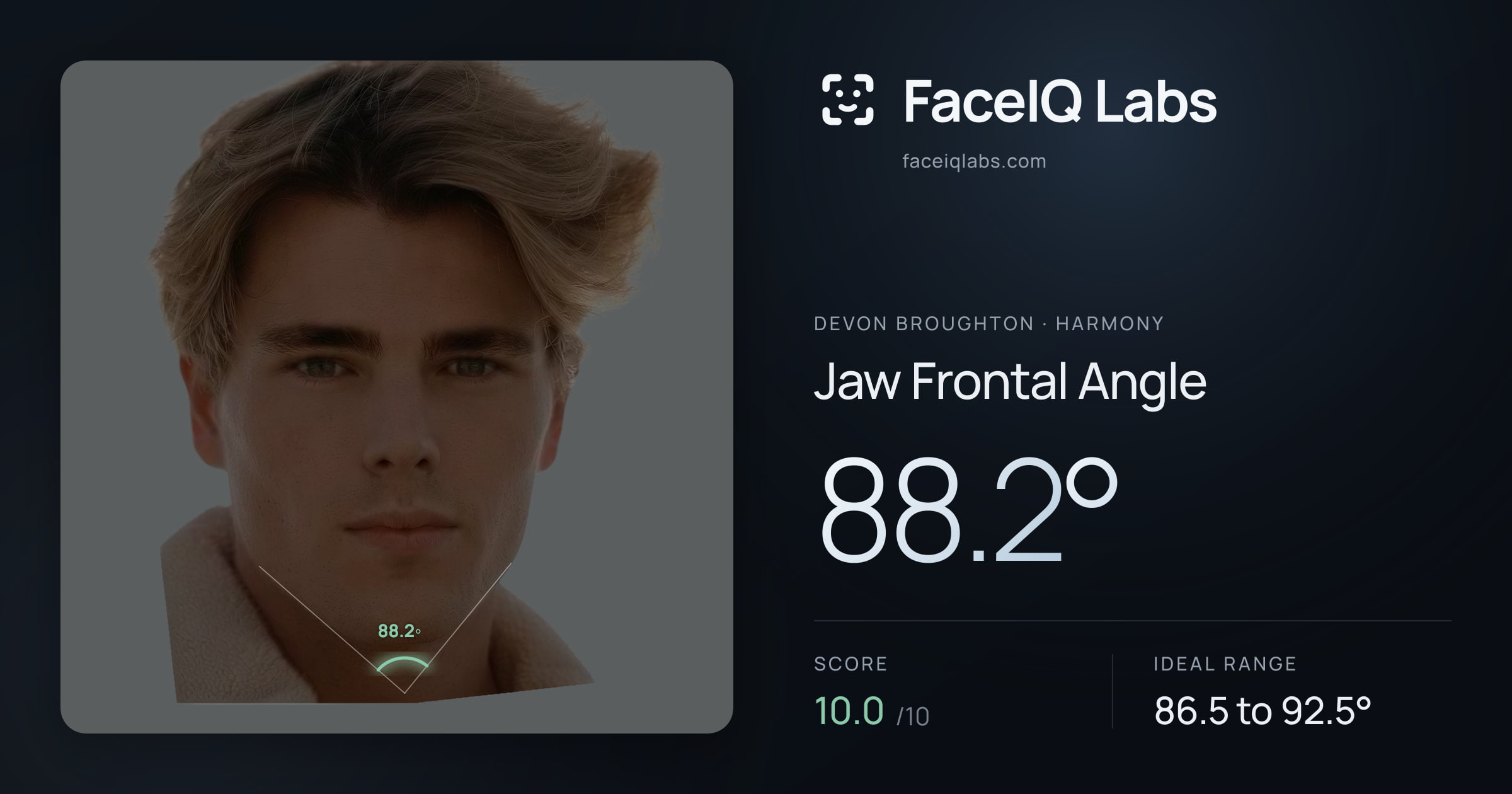 Devon Broughton Jaw Frontal Angle: 88.2°, drawn on the photo