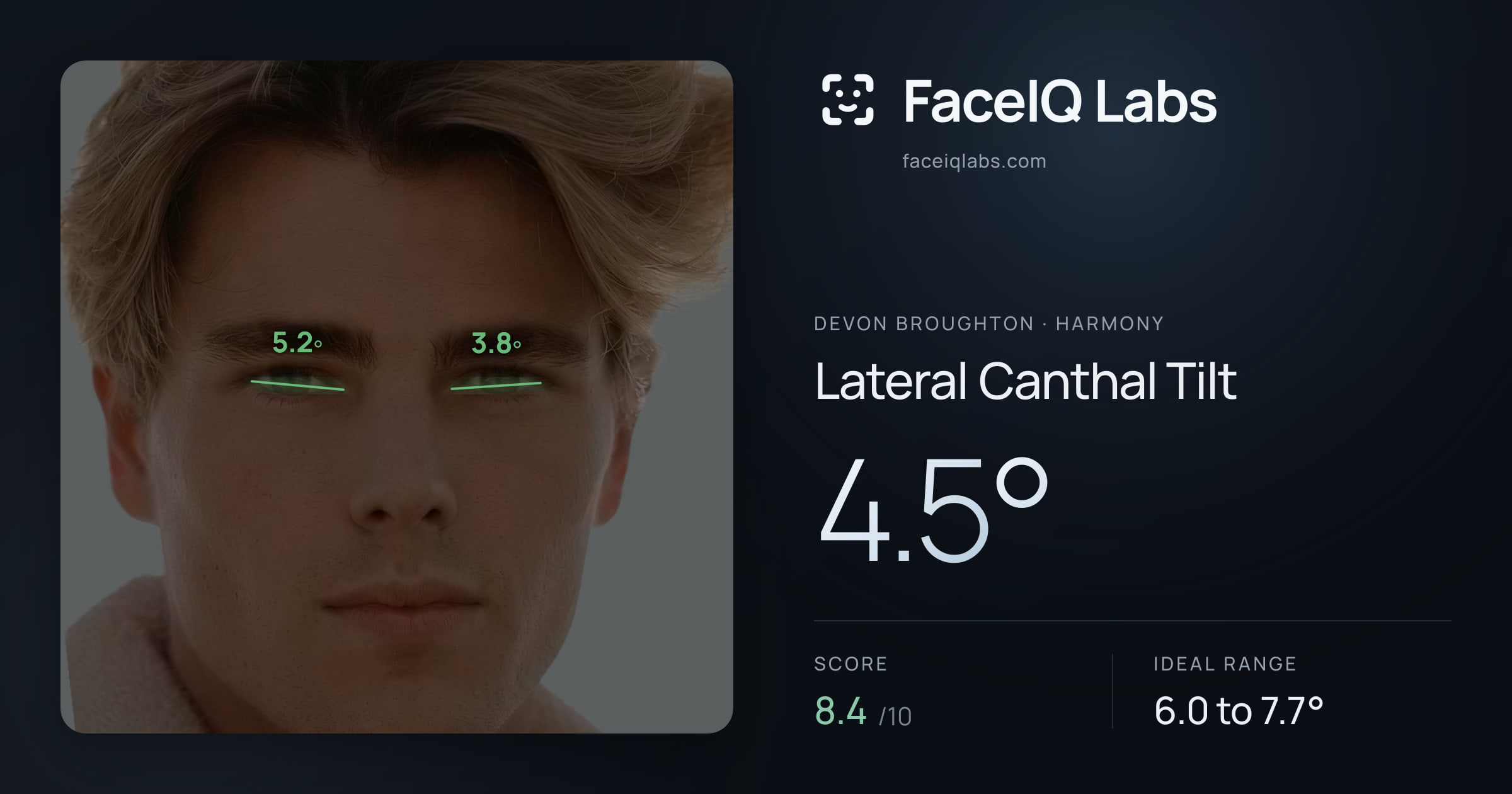 Devon Broughton Lateral Canthal Tilt: 4.5°, drawn on the photo