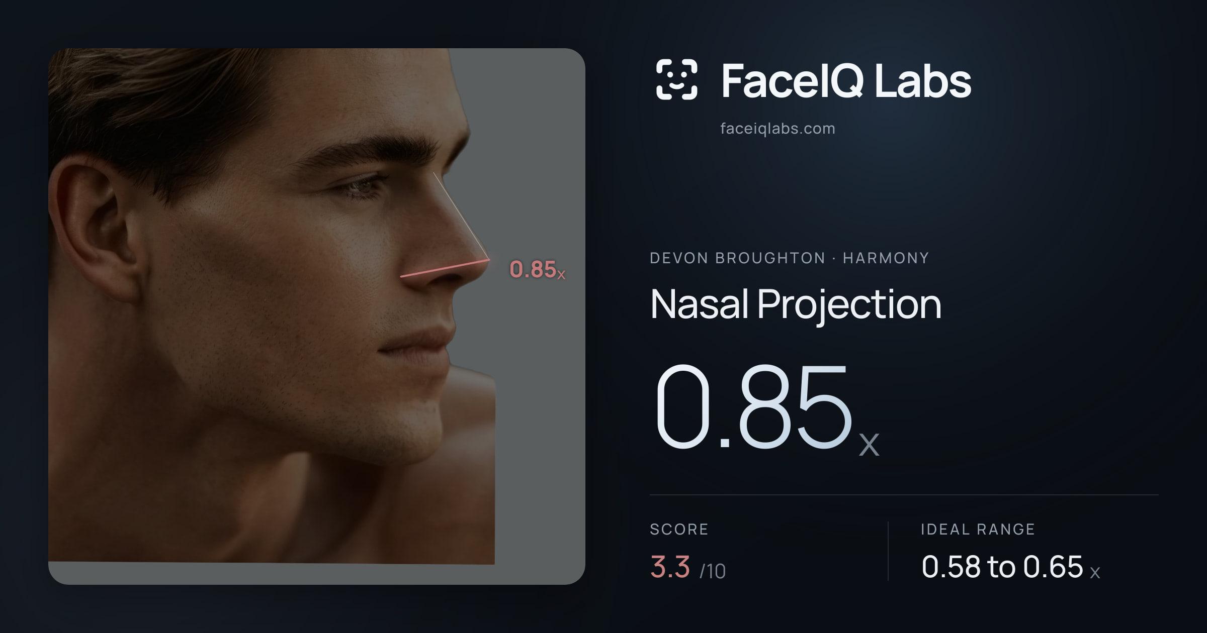 Devon Broughton Nasal Projection: 0.85x, drawn on the photo