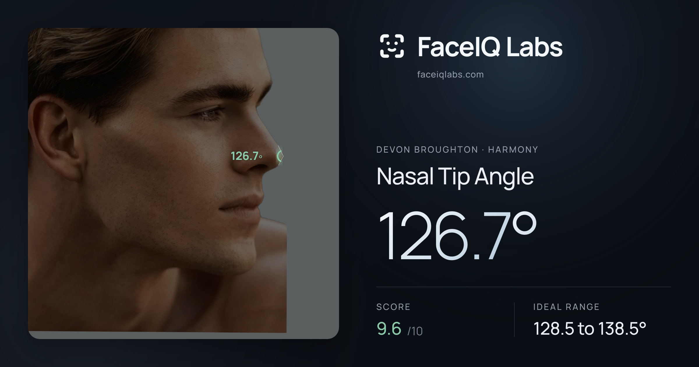 Devon Broughton Nasal Tip Angle: 126.7°, drawn on the photo