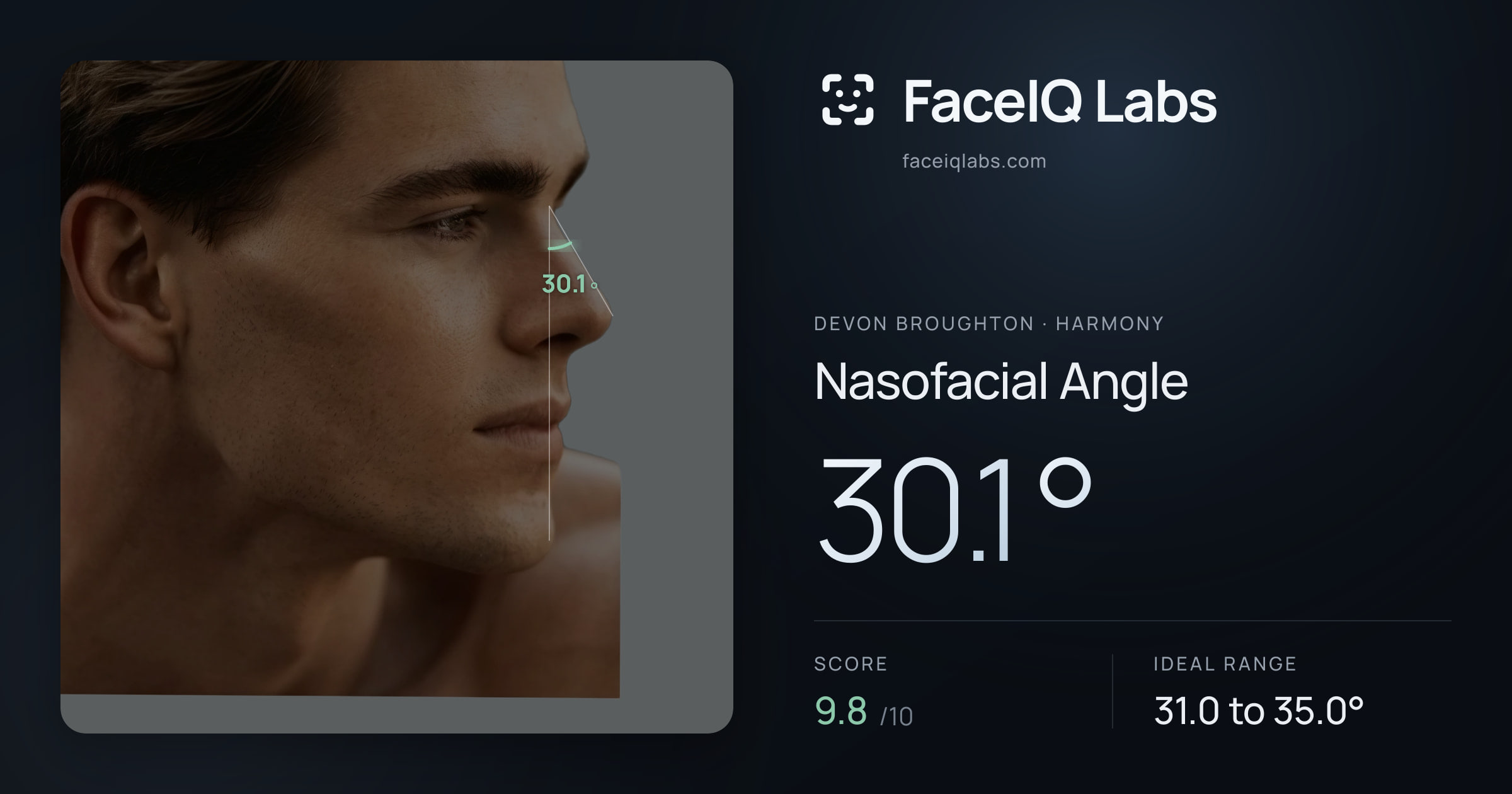 Devon Broughton Nasofacial Angle: 30.1°, drawn on the photo