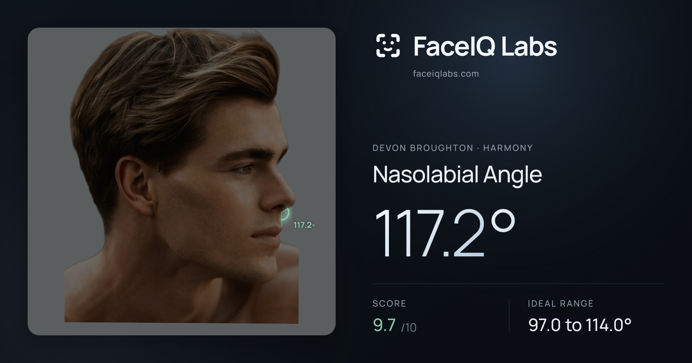 Devon Broughton Nasolabial Angle: 117.2°, drawn on the photo