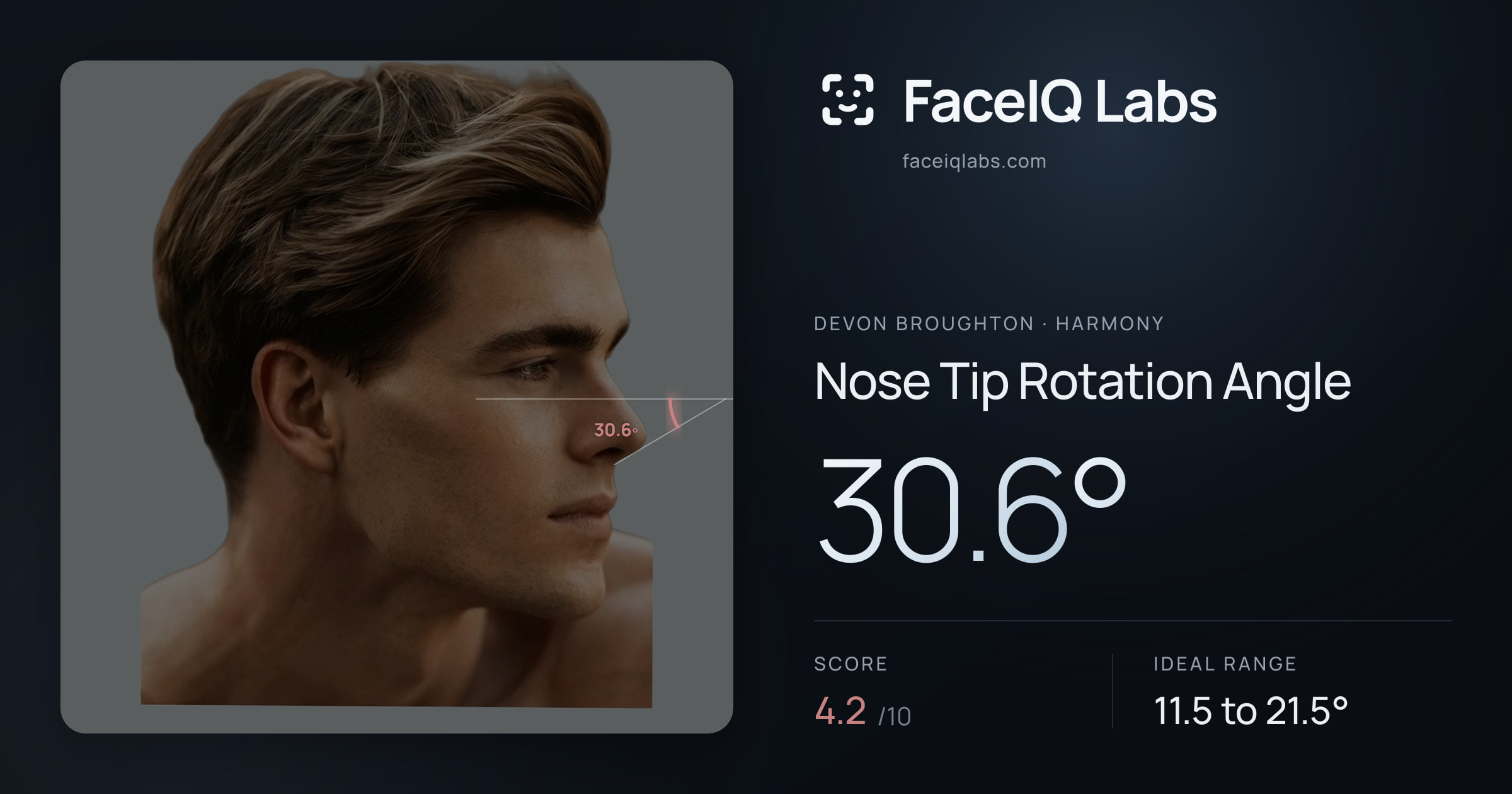 Devon Broughton Nose Tip Rotation Angle: 30.6°, drawn on the photo