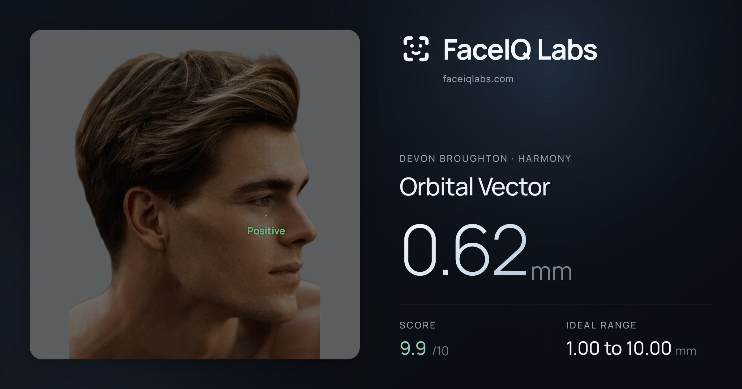 Devon Broughton Orbital Vector: 0.62mm, drawn on the photo