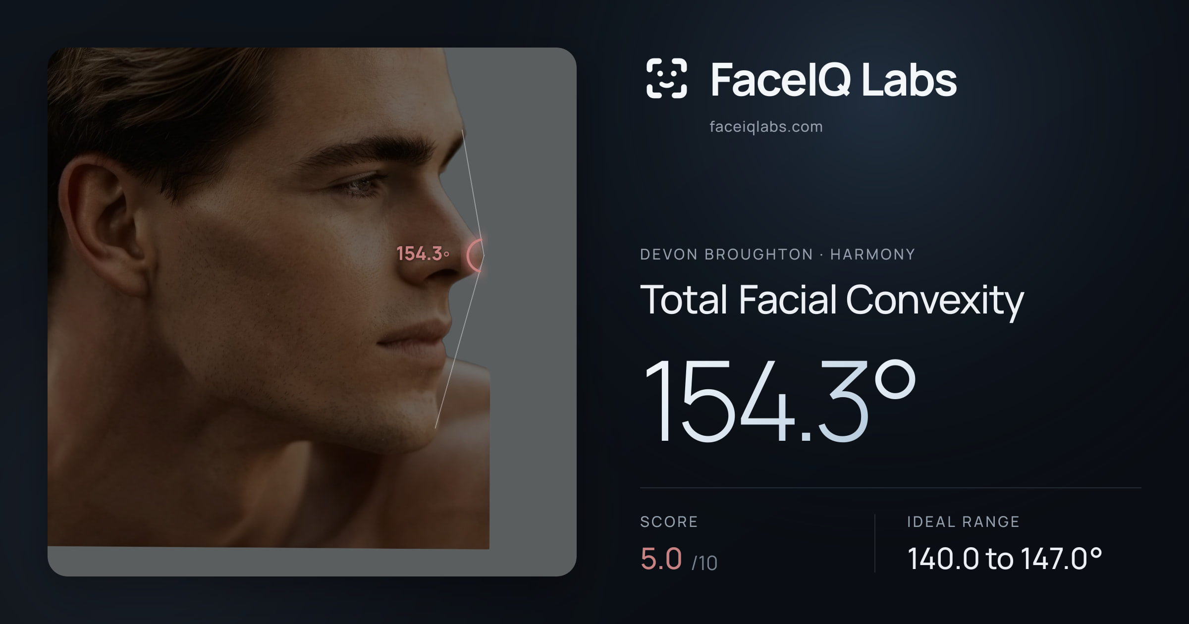 Devon Broughton Total Facial Convexity: 154.3°, drawn on the photo