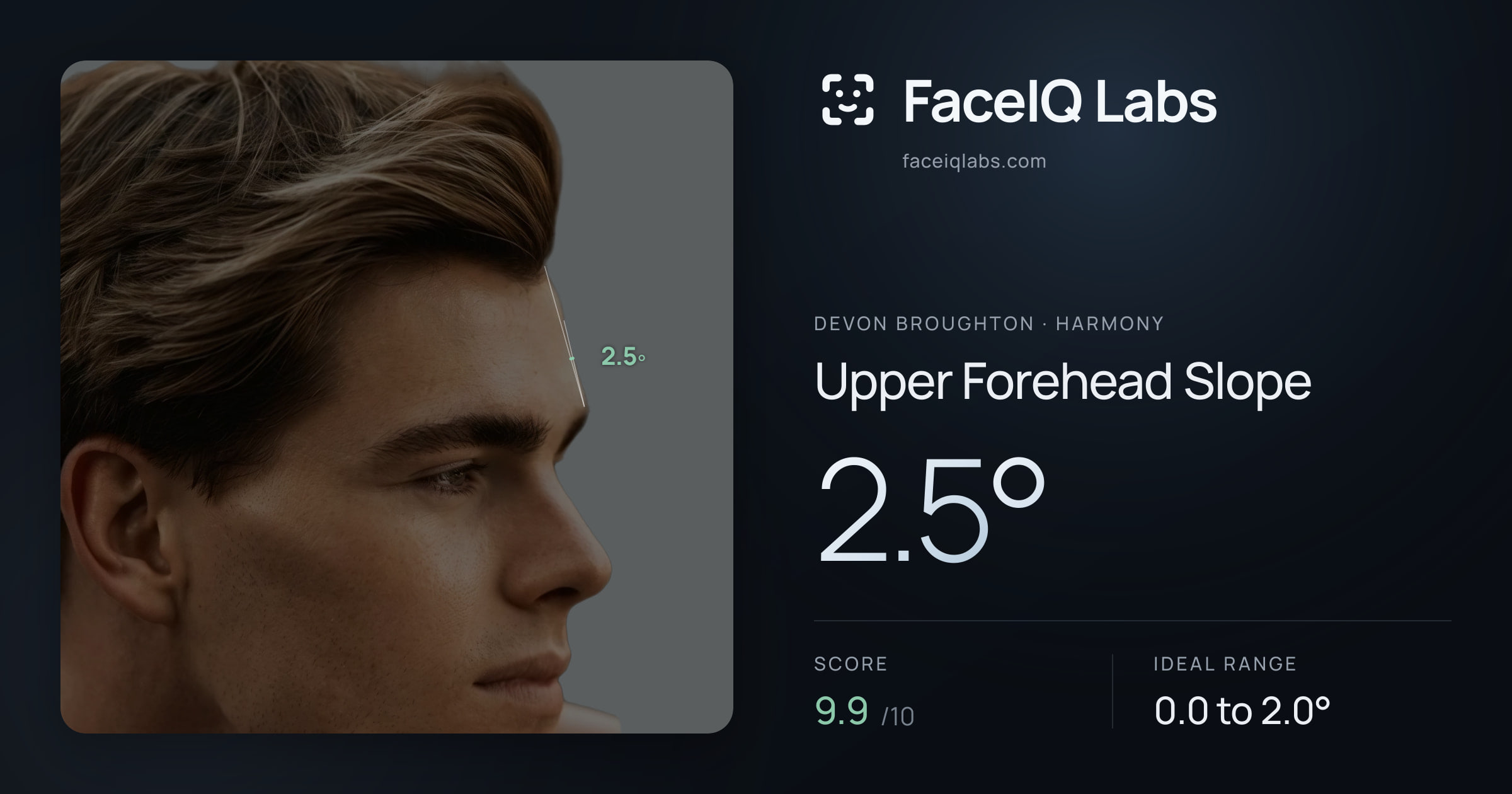 Devon Broughton Upper Forehead Slope: 2.5°, drawn on the photo