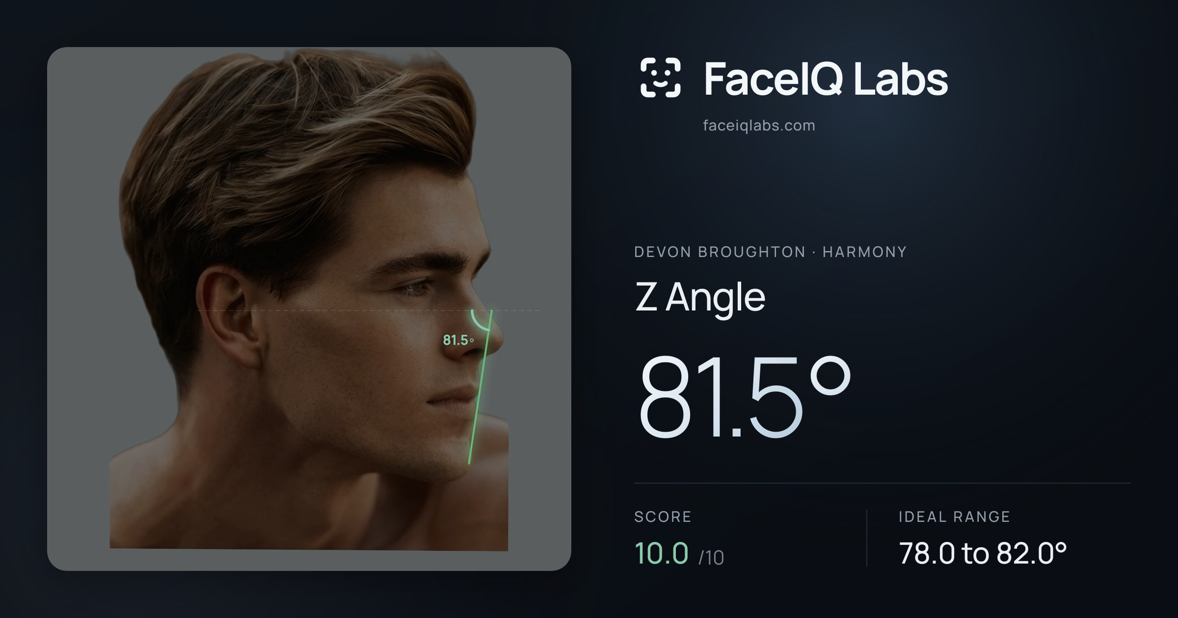 Devon Broughton Z Angle: 81.5°, drawn on the photo
