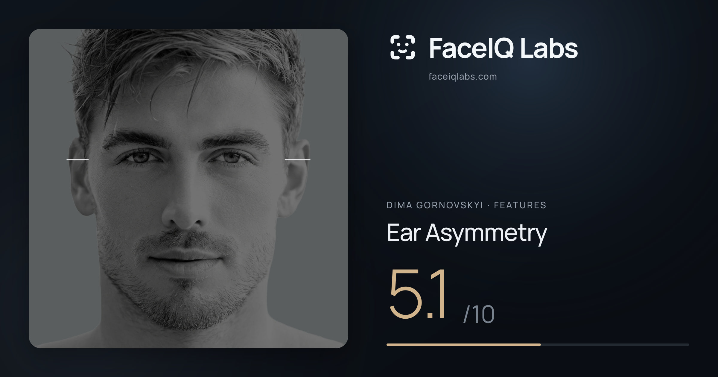 Dima Gornovskyi Ear Asymmetry: 5.1/10, drawn on the photo