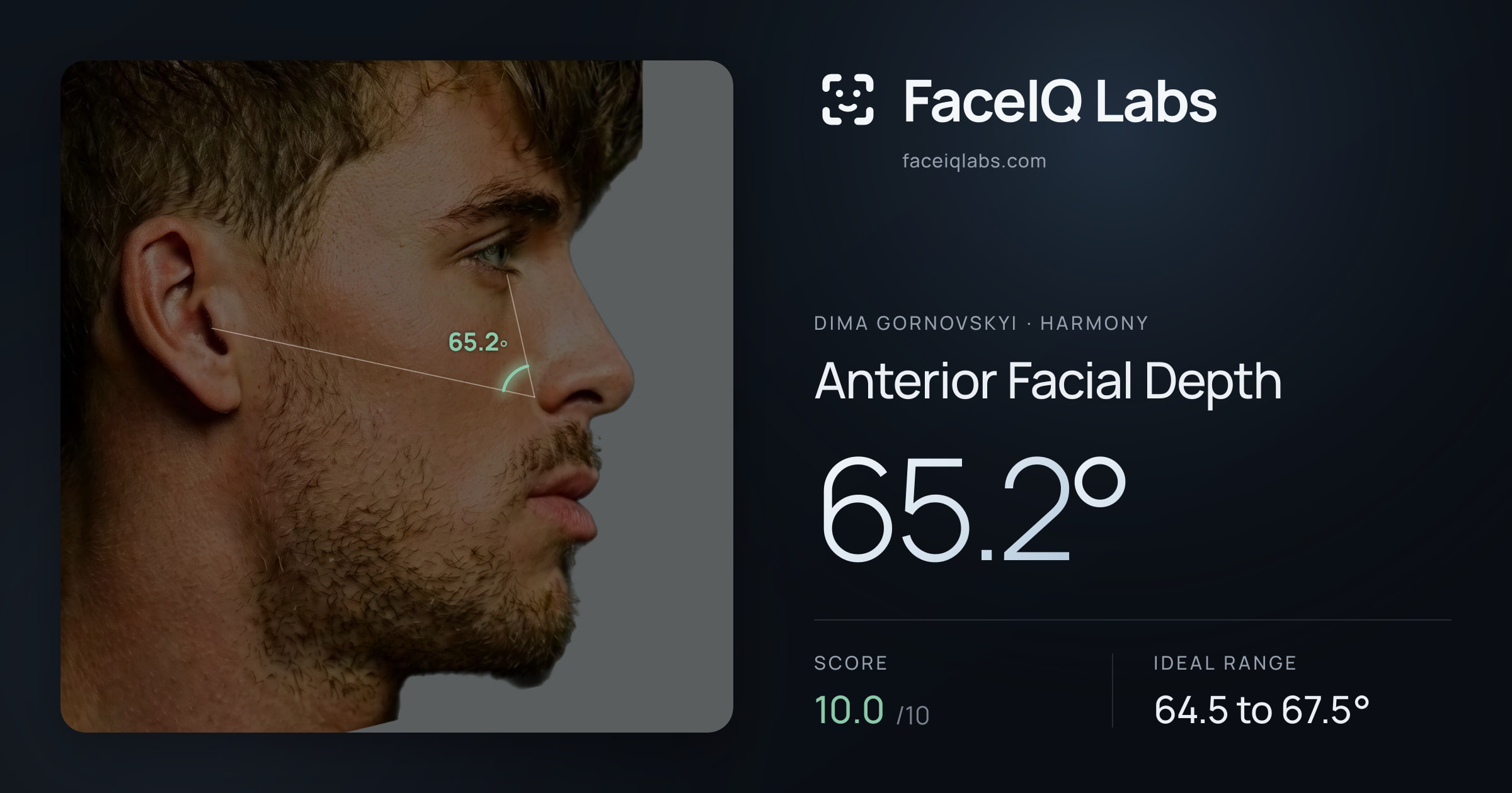 Dima Gornovskyi Anterior Facial Depth: 65.2°, drawn on the photo