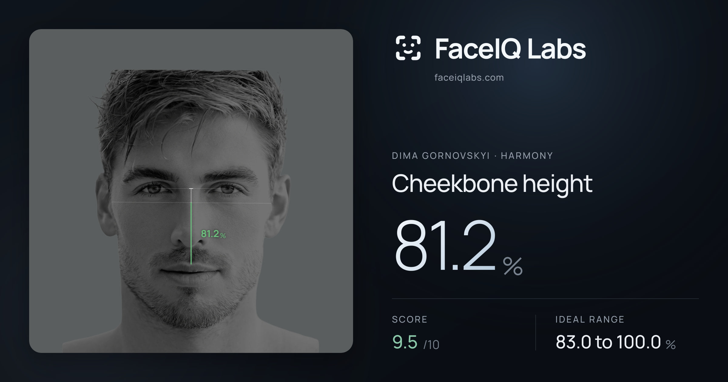 Dima Gornovskyi Cheekbone height: 81.2%, drawn on the photo