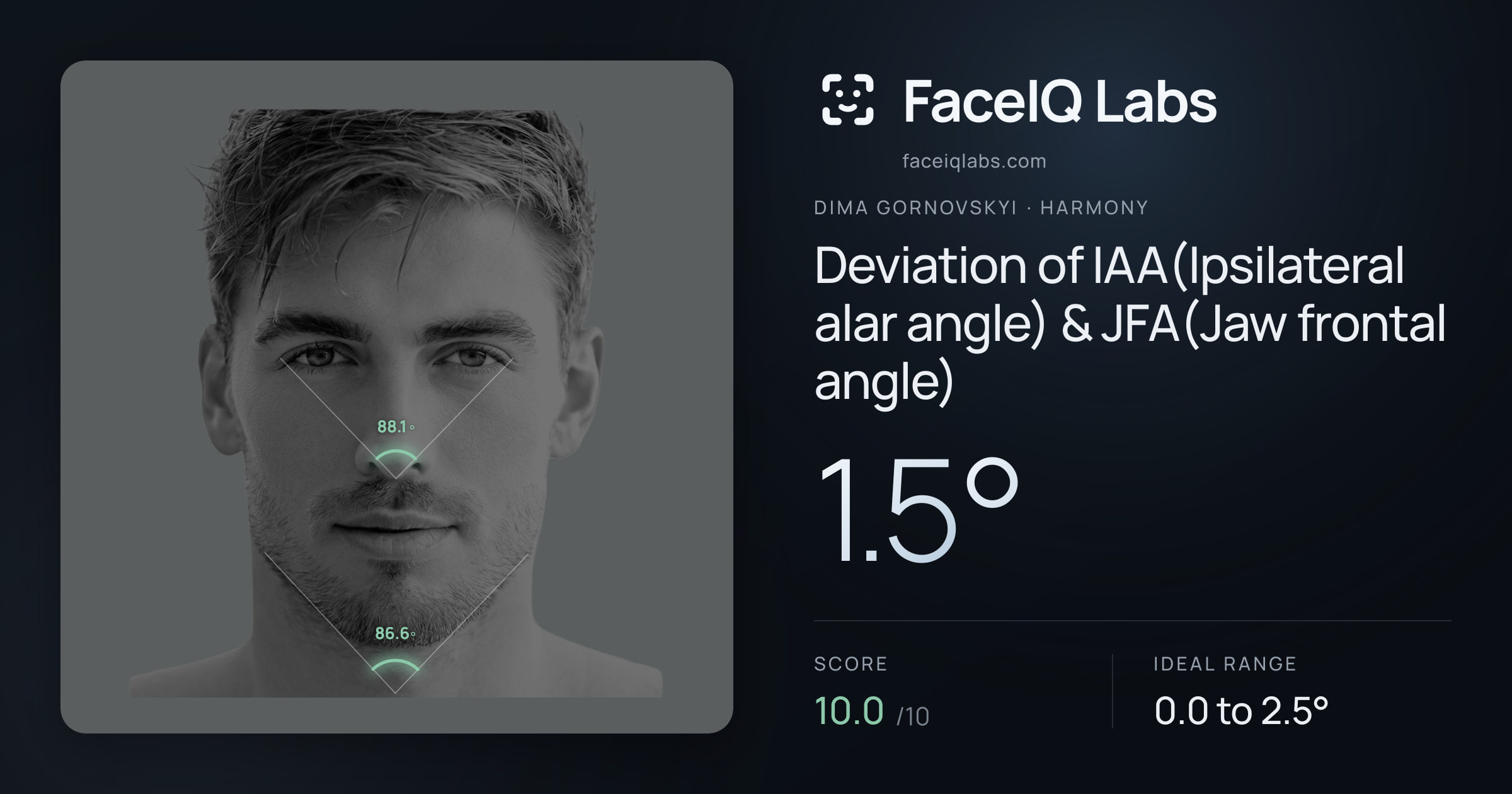 Dima Gornovskyi Deviation of IAA(Ipsilateral alar angle) & JFA(Jaw frontal angle): 1.5°, drawn on the photo