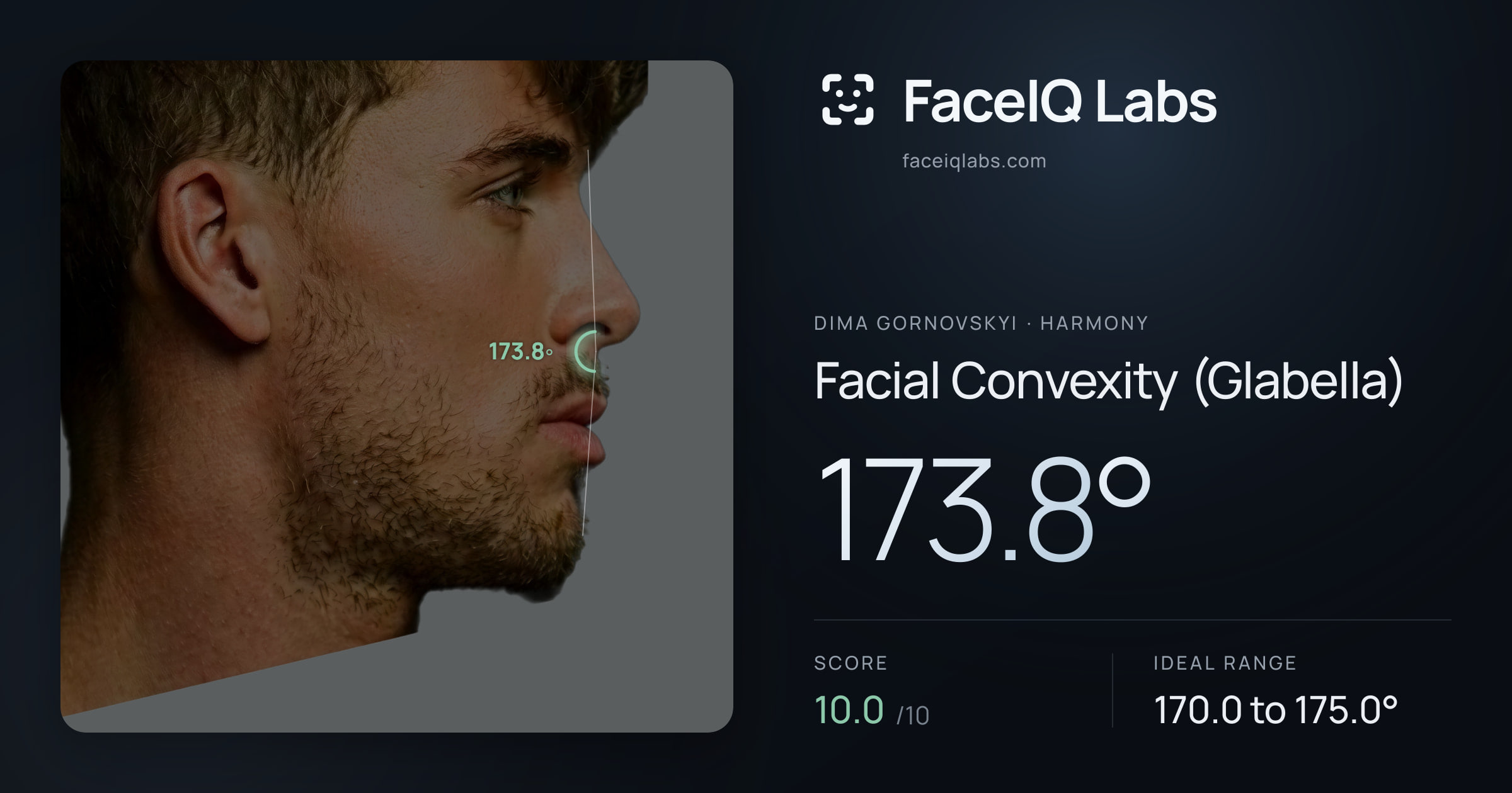 Dima Gornovskyi Facial Convexity (Glabella): 173.8°, drawn on the photo