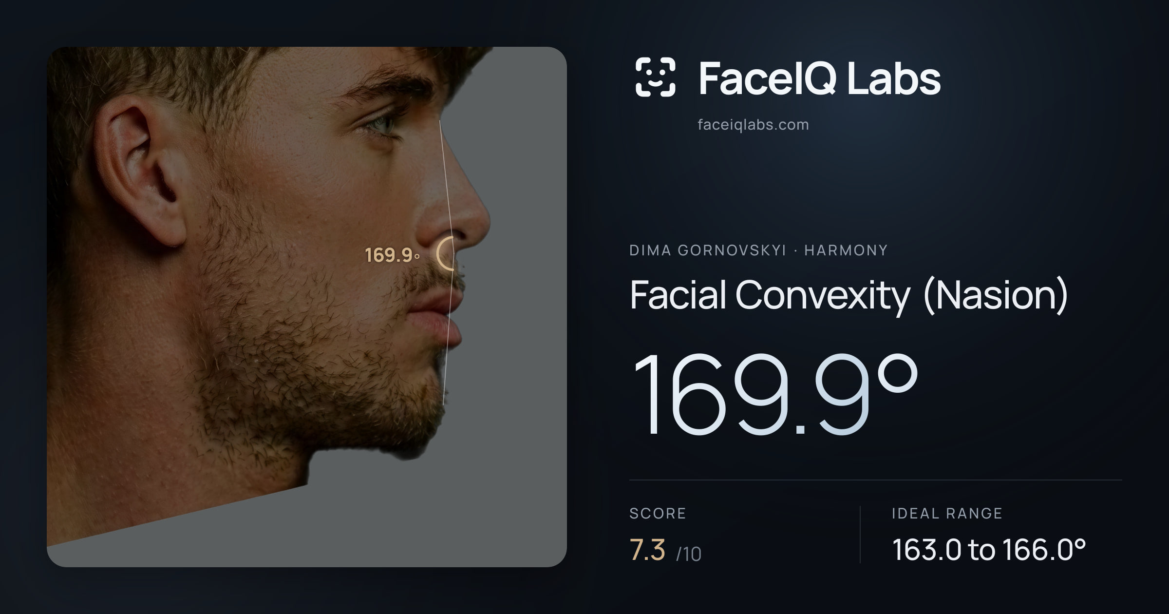 Dima Gornovskyi Facial Convexity (Nasion): 169.9°, drawn on the photo