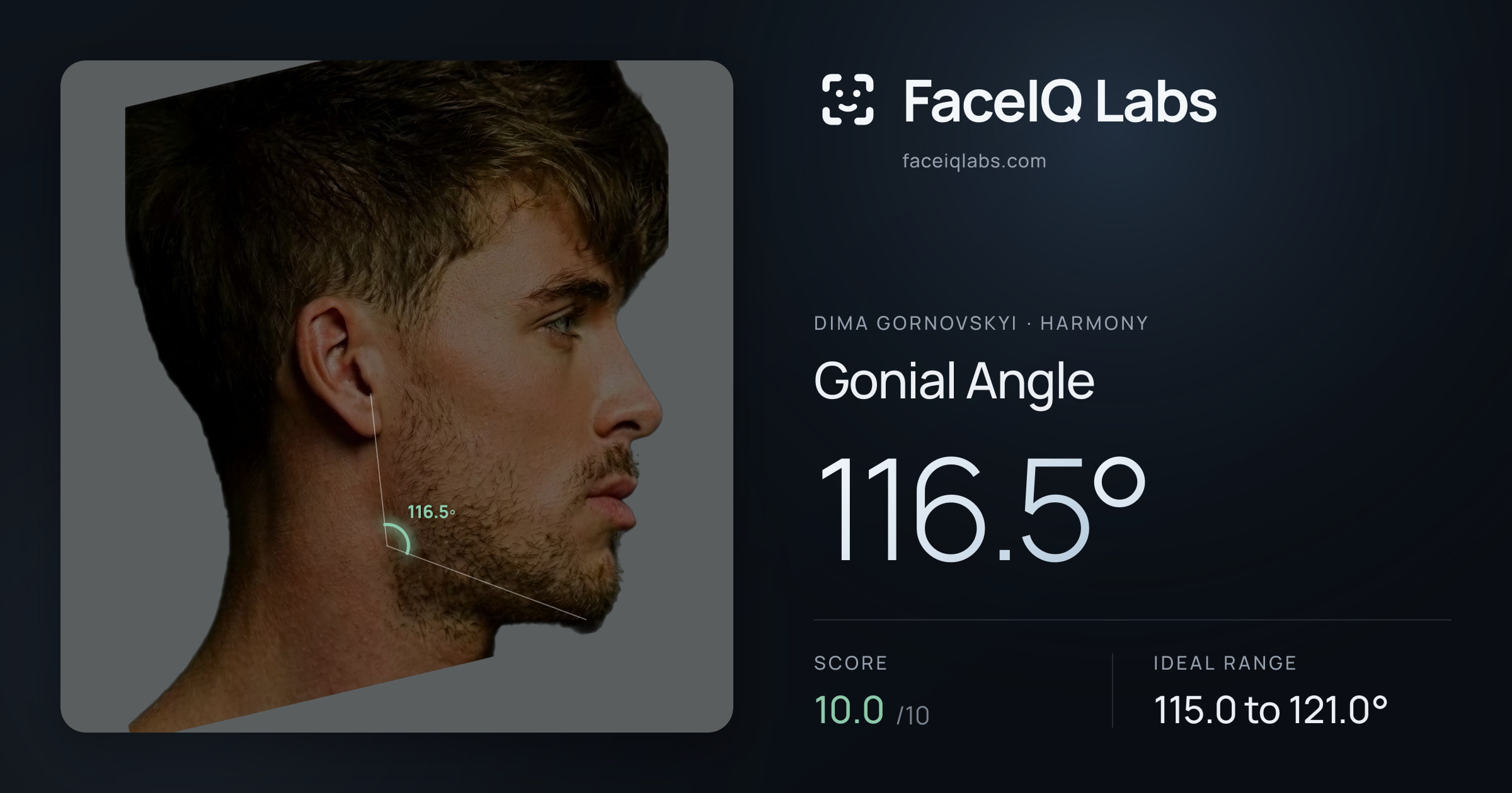 Dima Gornovskyi Gonial Angle: 116.5°, drawn on the photo