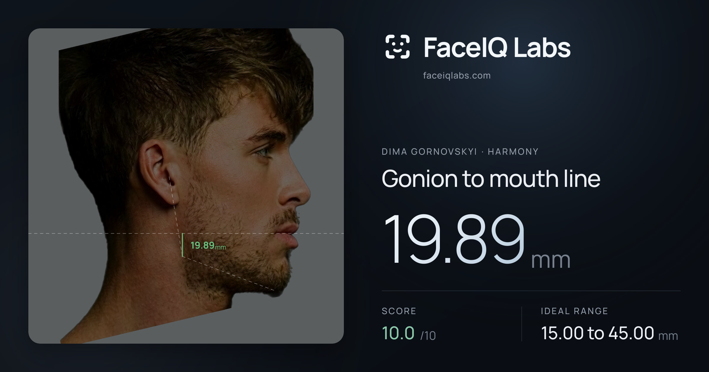 Dima Gornovskyi Gonion to mouth line: 19.89mm, drawn on the photo