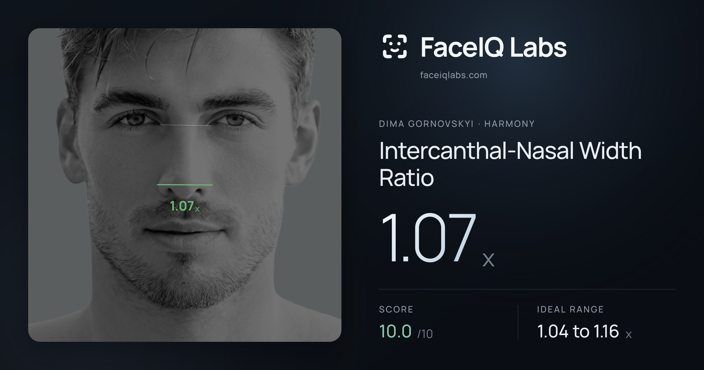 Dima Gornovskyi Intercanthal-Nasal Width Ratio: 1.07x, drawn on the photo