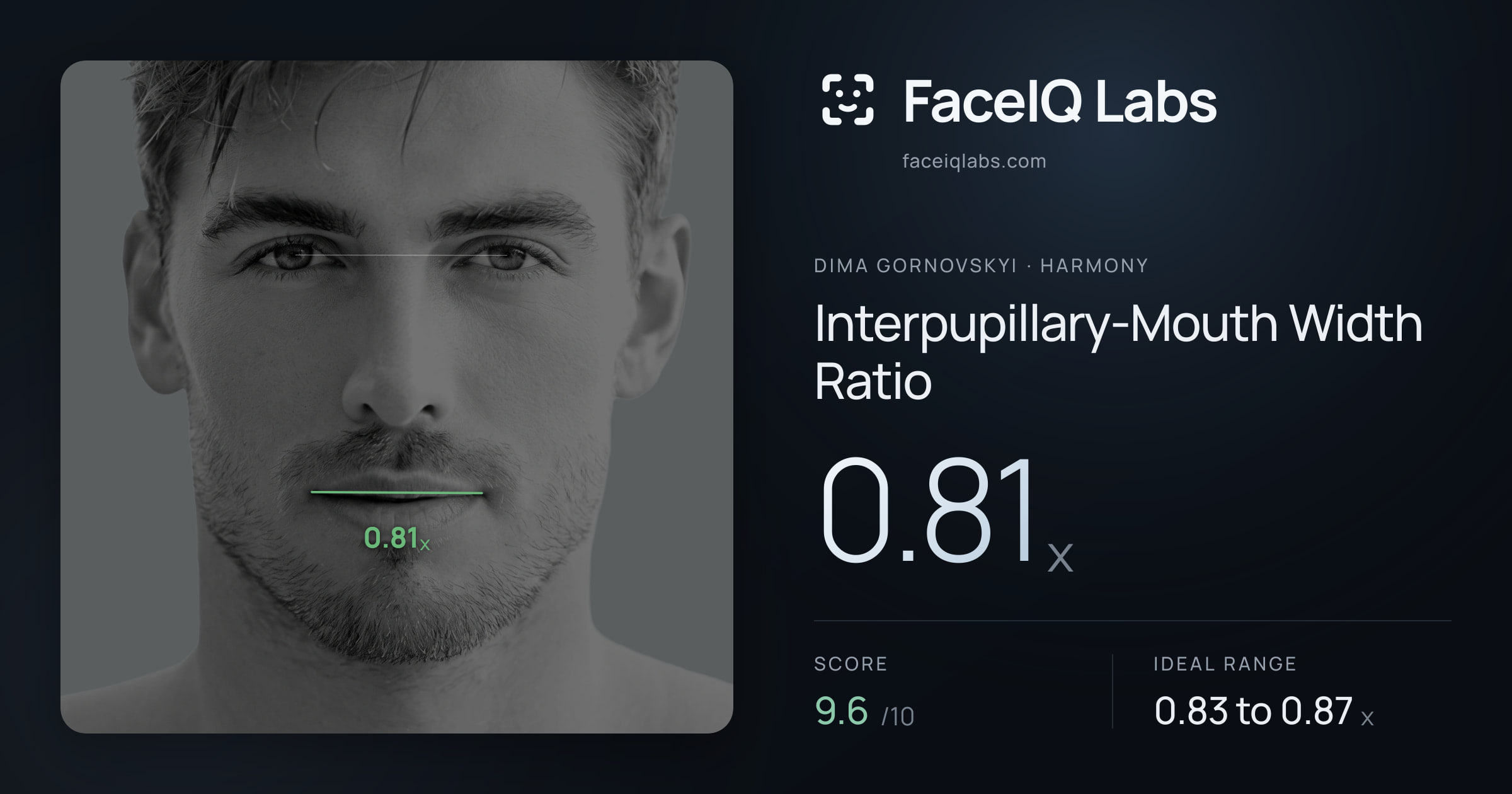 Dima Gornovskyi Interpupillary-Mouth Width Ratio: 0.81x, drawn on the photo