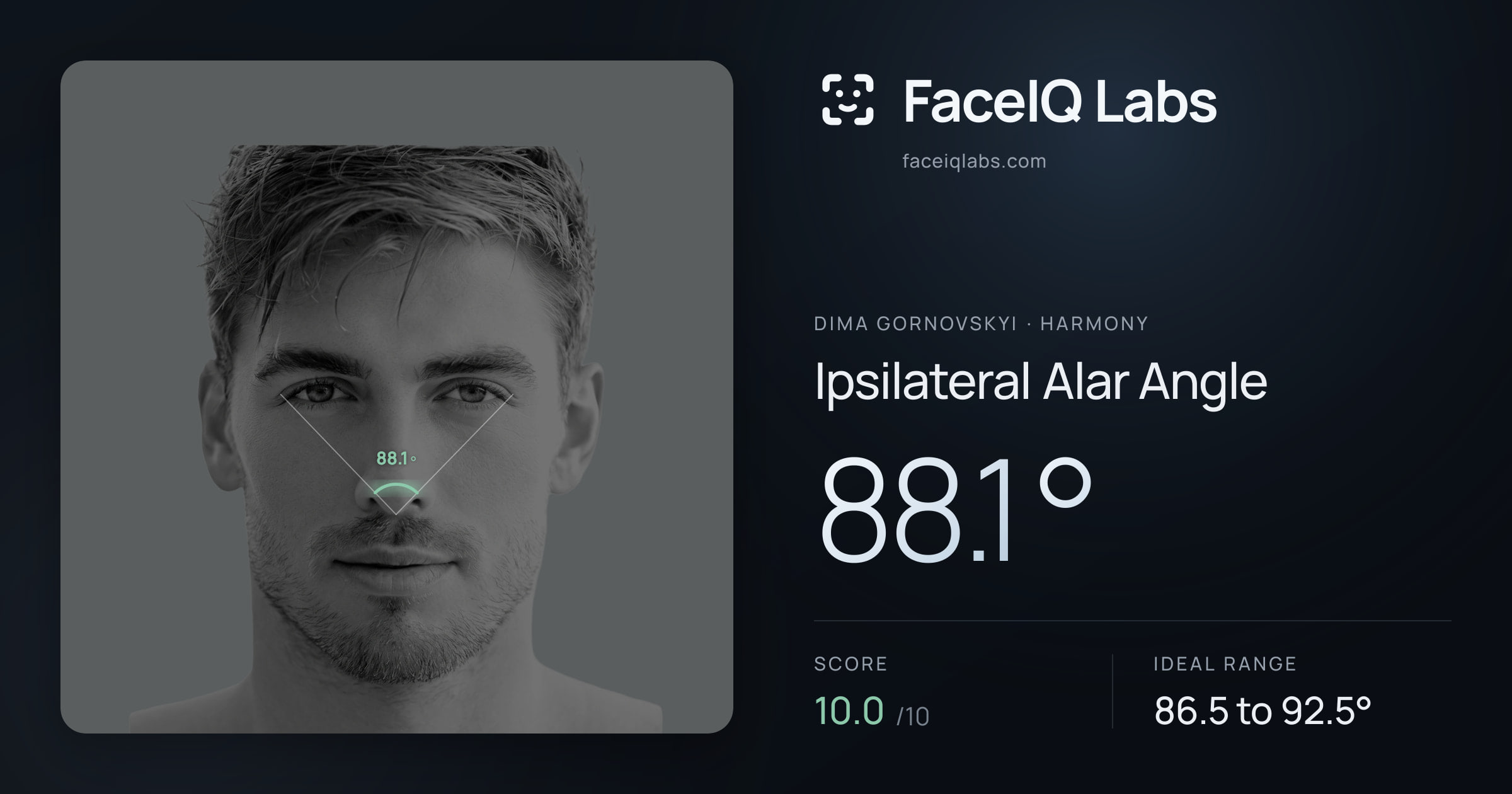 Dima Gornovskyi Ipsilateral Alar Angle: 88.1°, drawn on the photo