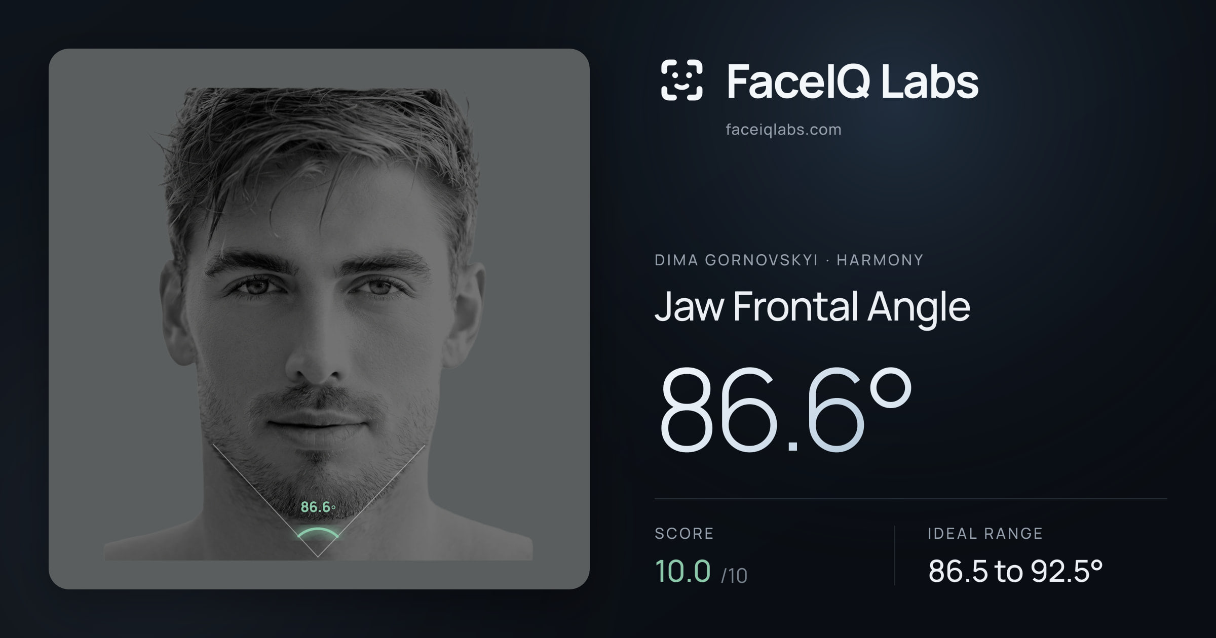 Dima Gornovskyi Jaw Frontal Angle: 86.6°, drawn on the photo