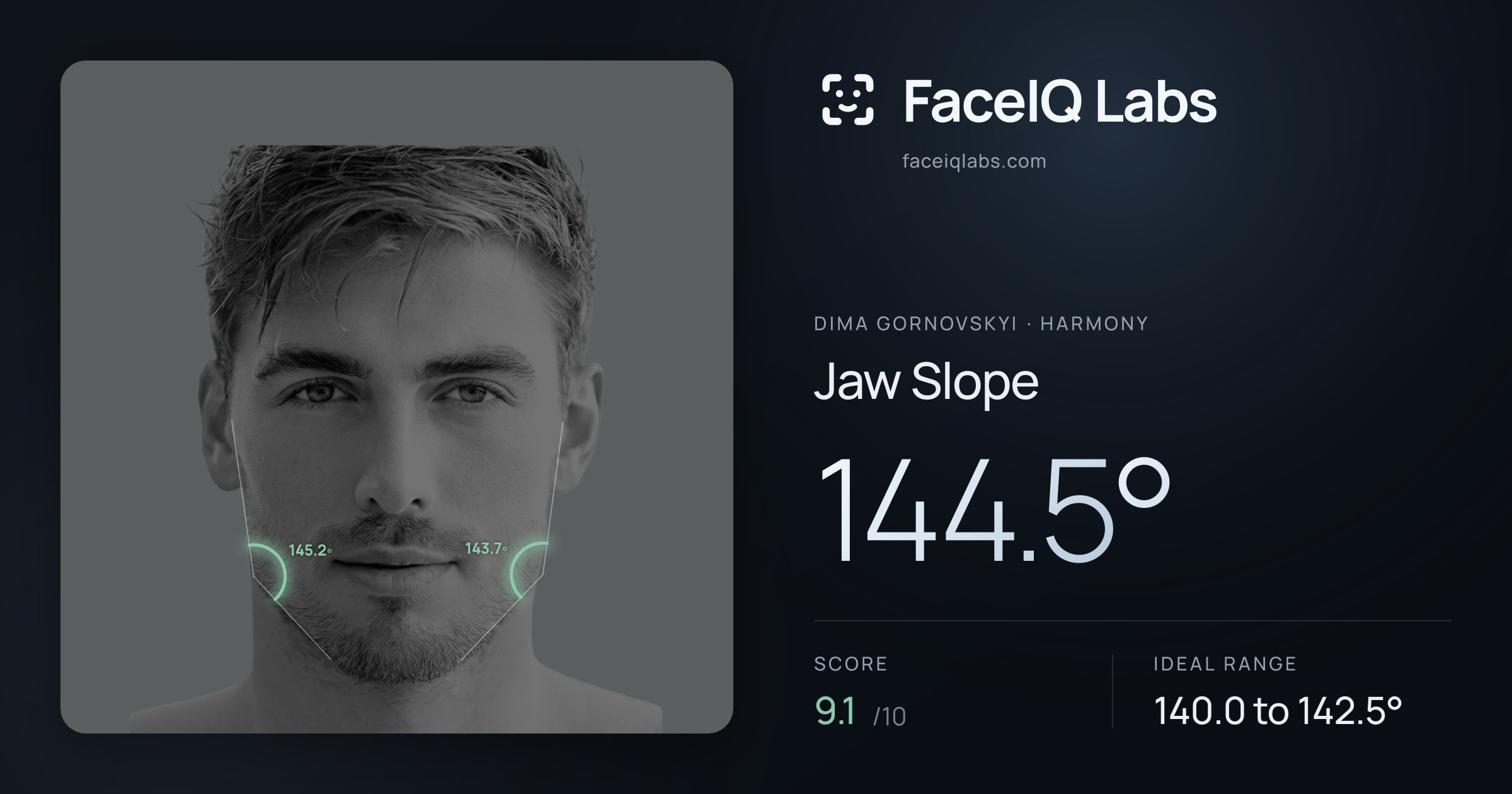 Dima Gornovskyi Jaw Slope: 144.5°, drawn on the photo