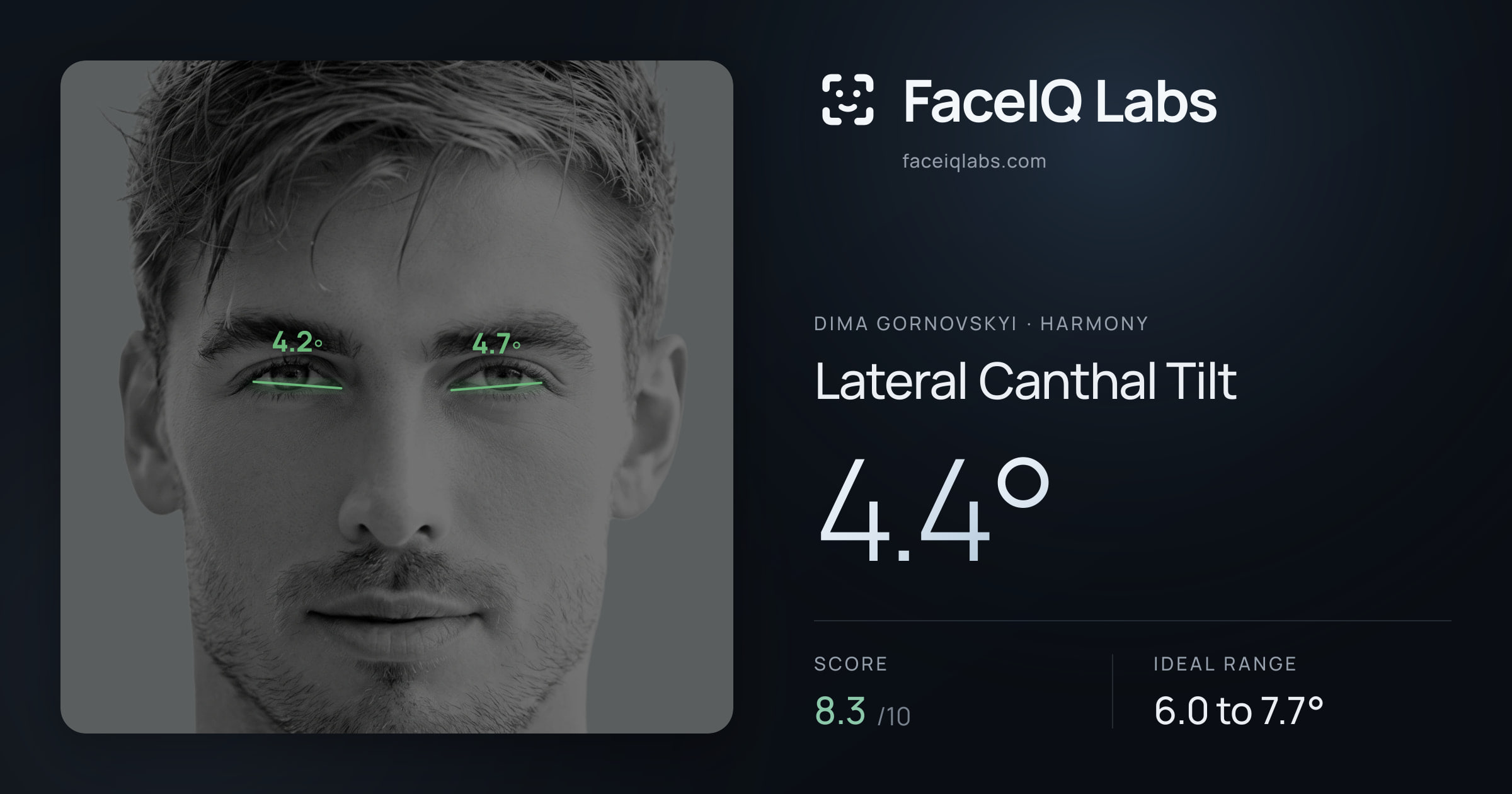 Dima Gornovskyi Lateral Canthal Tilt: 4.4°, drawn on the photo