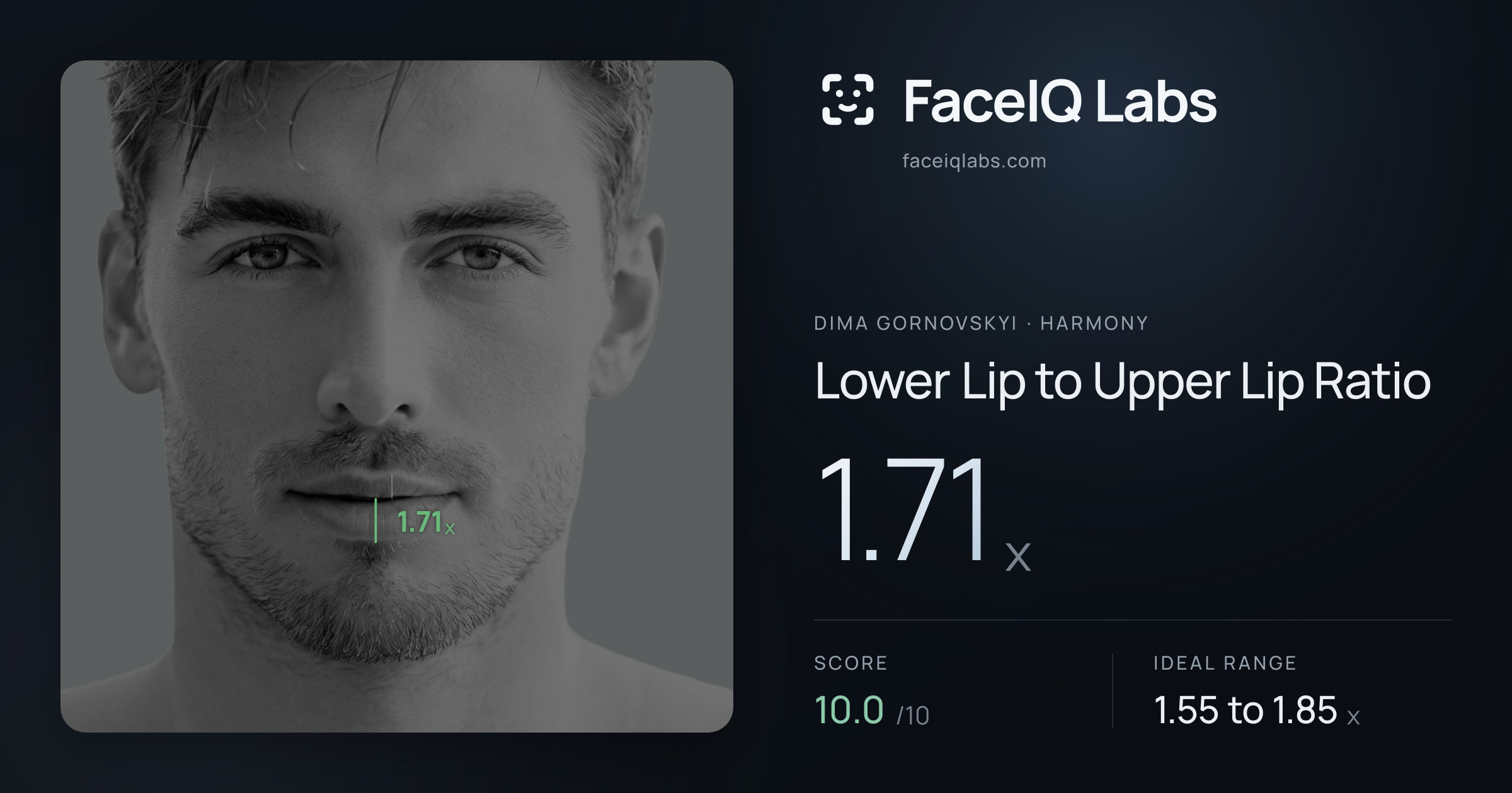 Dima Gornovskyi Lower Lip to Upper Lip Ratio: 1.71x, drawn on the photo