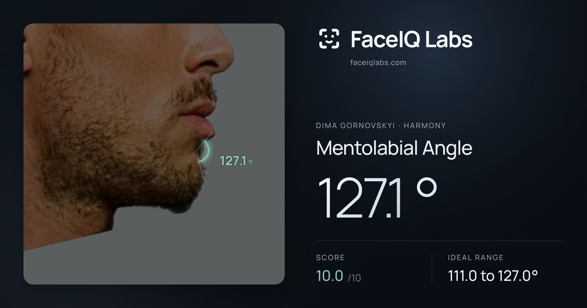 Dima Gornovskyi Mentolabial Angle: 127.1°, drawn on the photo