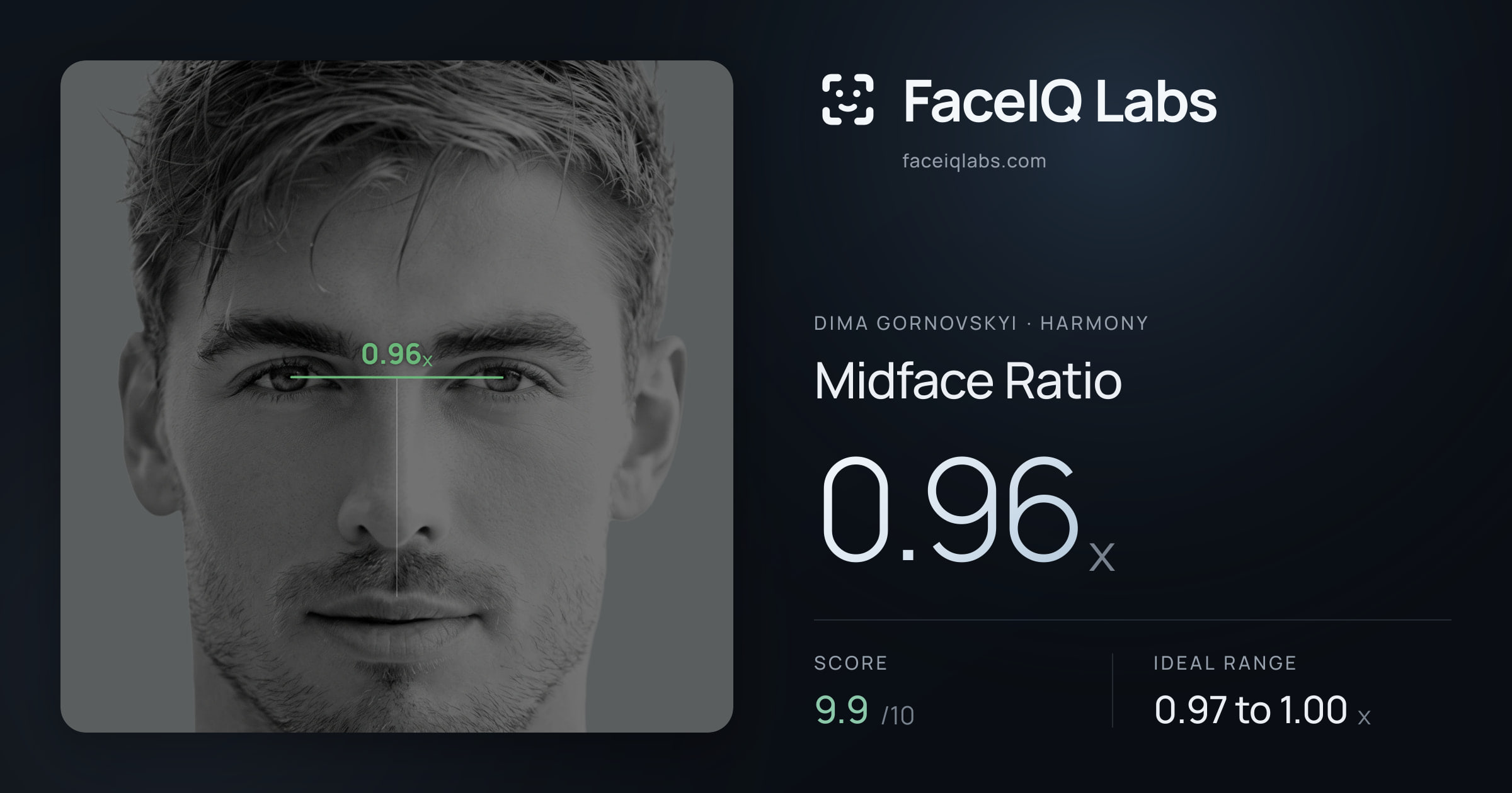 Dima Gornovskyi Midface Ratio: 0.96x, drawn on the photo