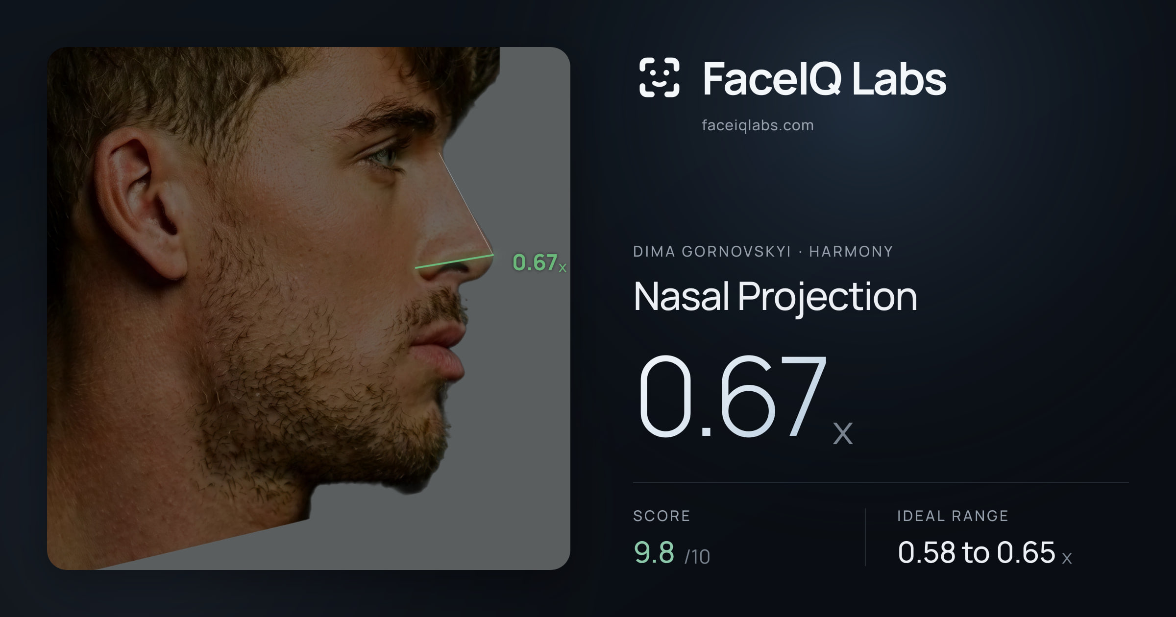 Dima Gornovskyi Nasal Projection: 0.67x, drawn on the photo