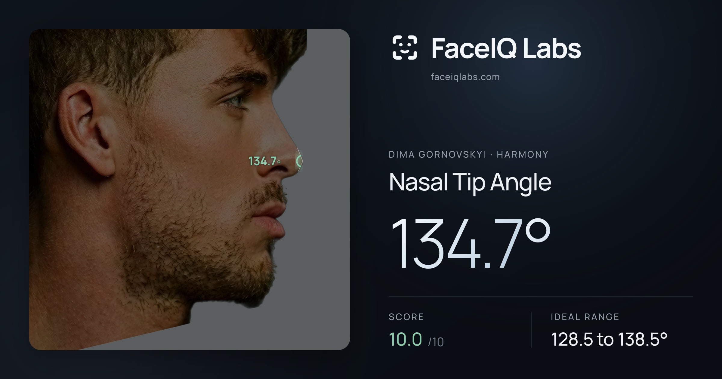 Dima Gornovskyi Nasal Tip Angle: 134.7°, drawn on the photo