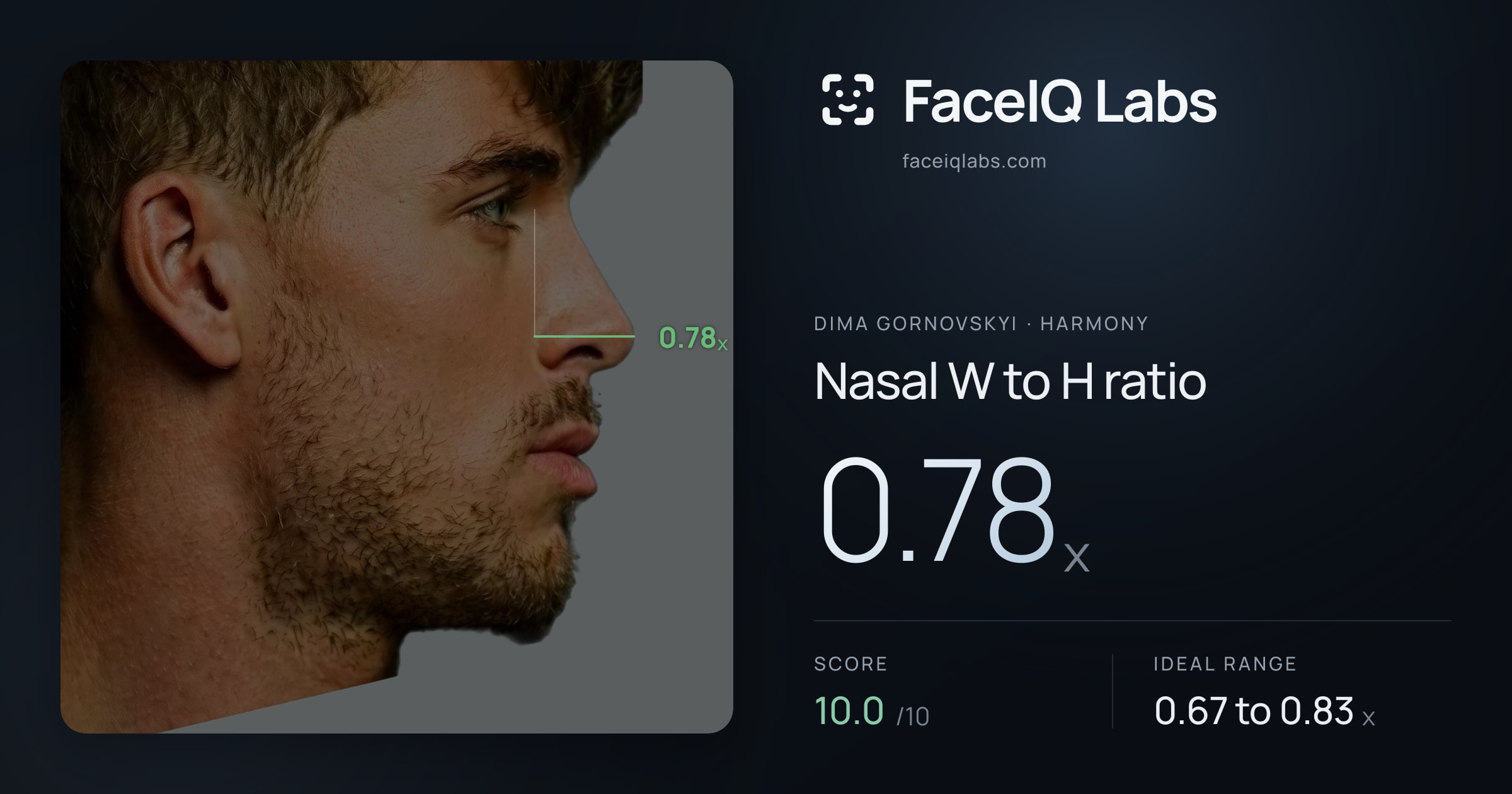 Dima Gornovskyi Nasal W to H ratio: 0.78x, drawn on the photo