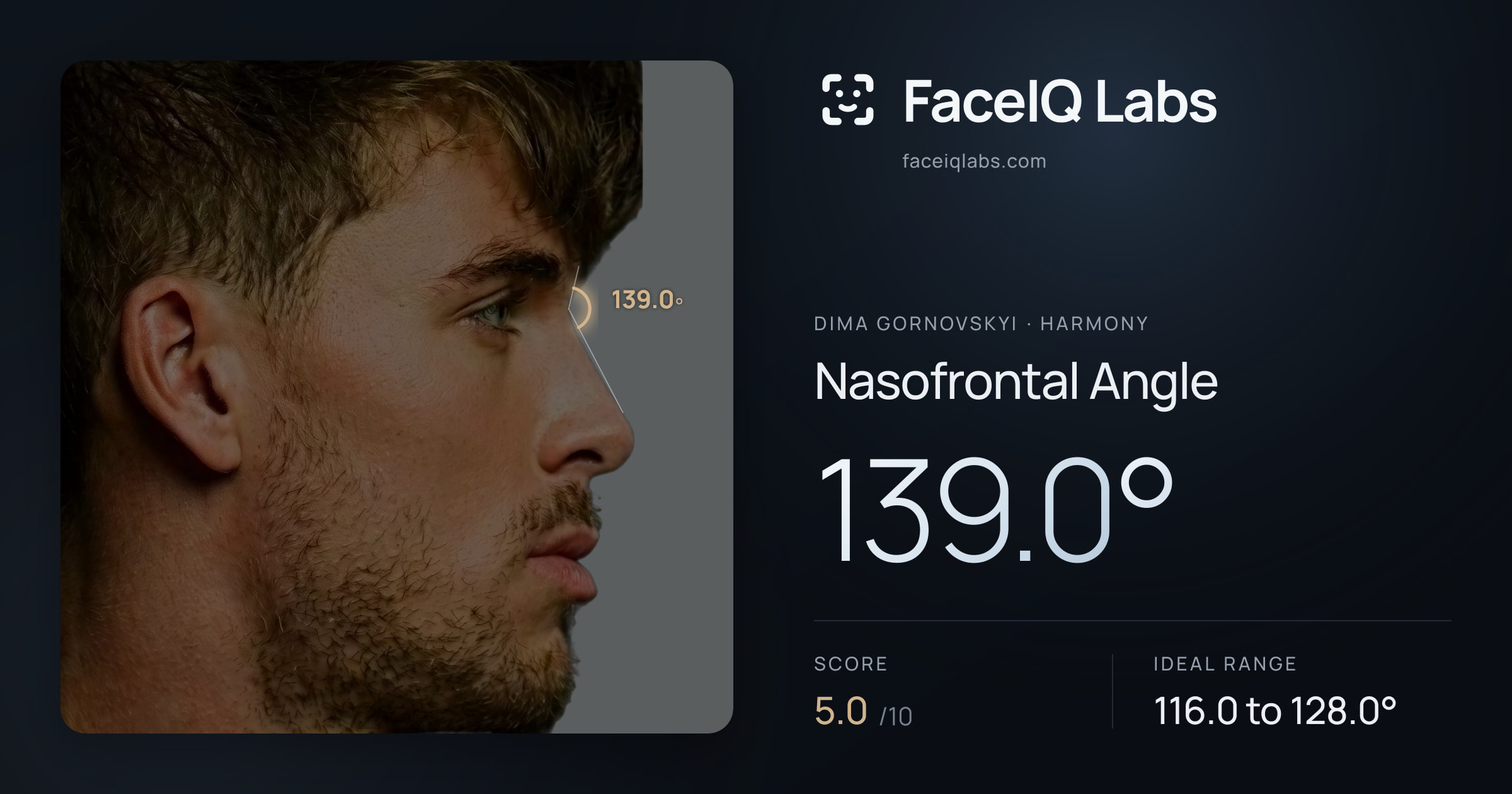 Dima Gornovskyi Nasofrontal Angle: 139.0°, drawn on the photo