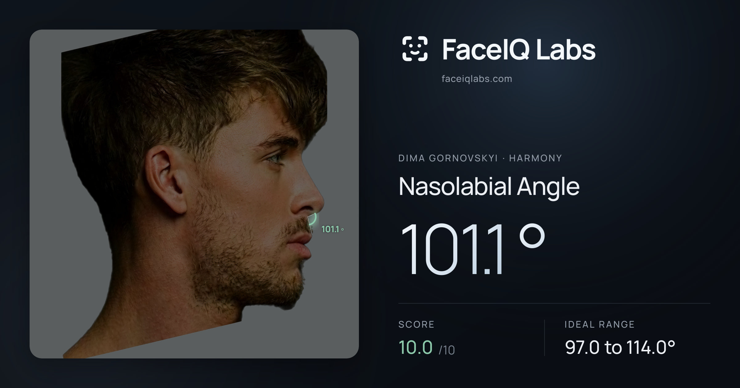 Dima Gornovskyi Nasolabial Angle: 101.1°, drawn on the photo