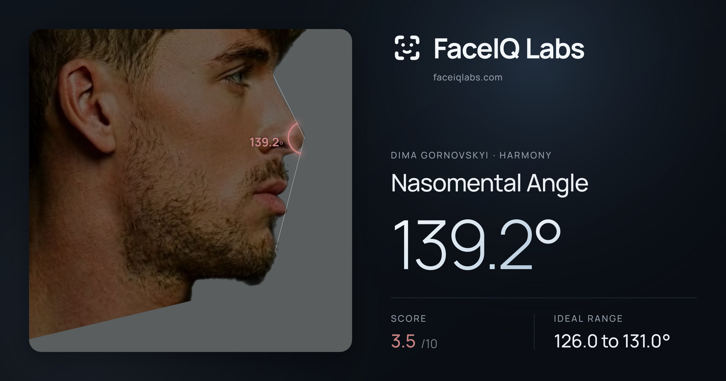 Dima Gornovskyi Nasomental Angle: 139.2°, drawn on the photo