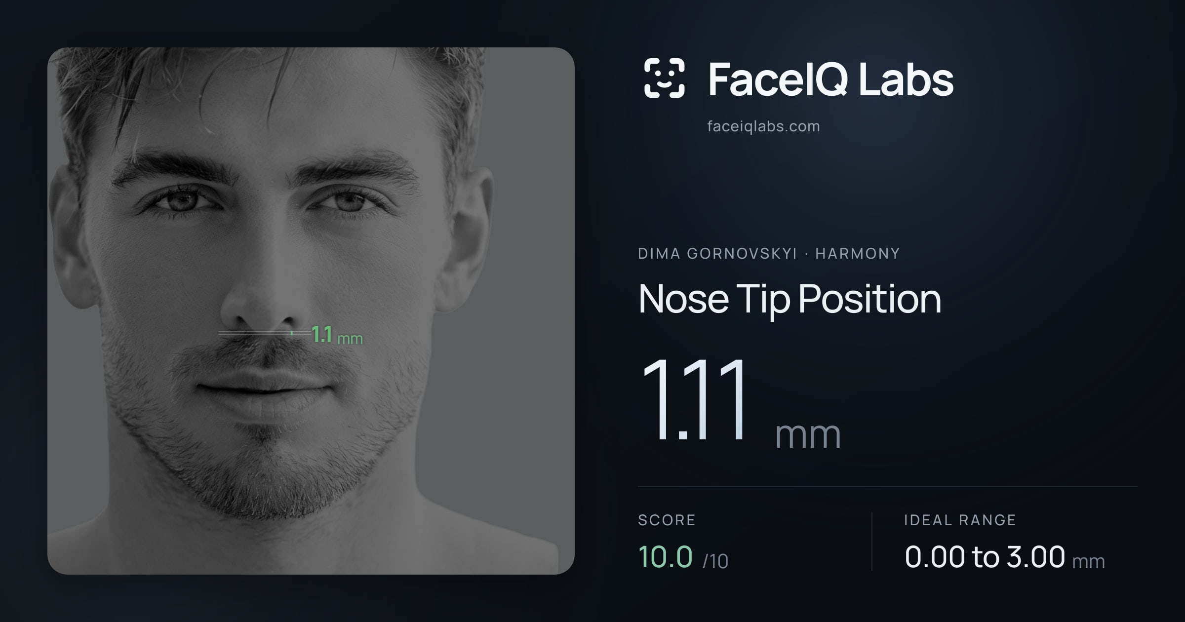 Dima Gornovskyi Nose Tip Position: 1.11mm, drawn on the photo
