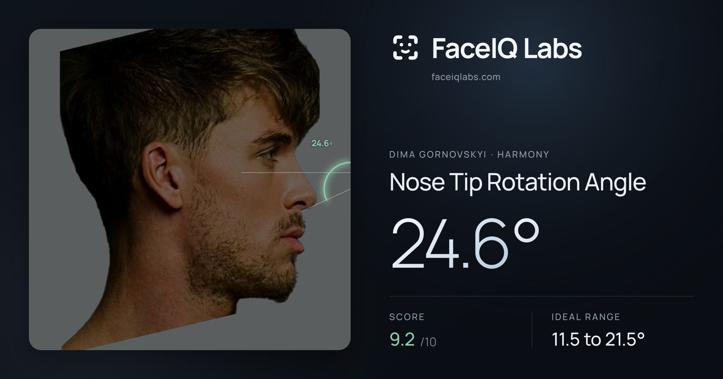 Dima Gornovskyi Nose Tip Rotation Angle: 24.6°, drawn on the photo