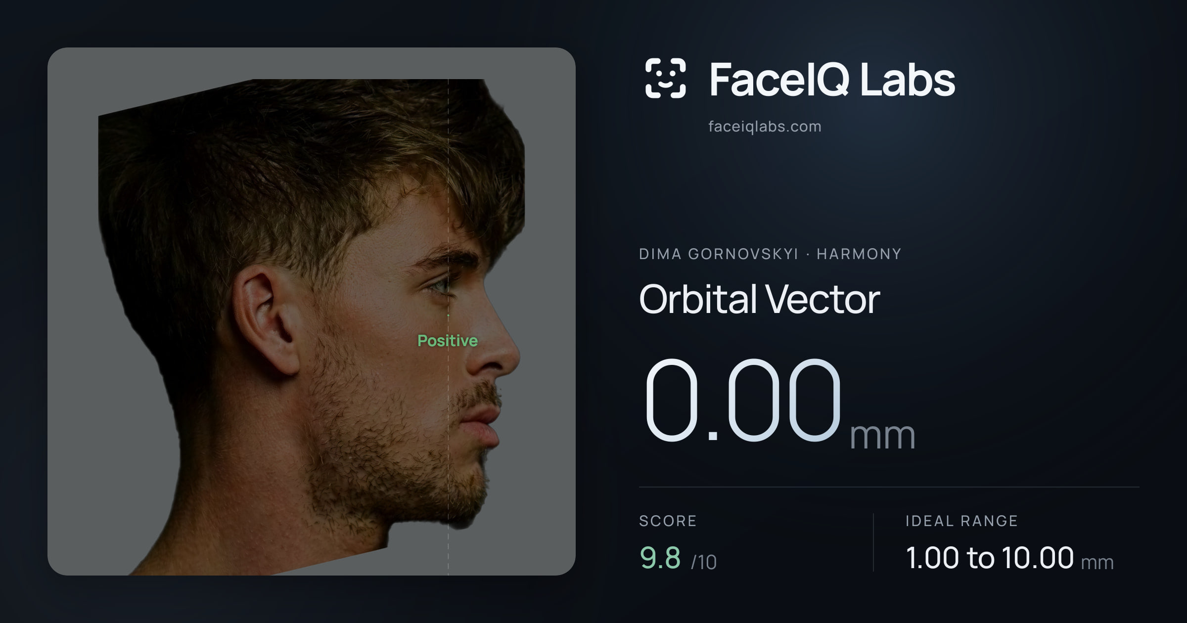 Dima Gornovskyi Orbital Vector: 0.00mm, drawn on the photo