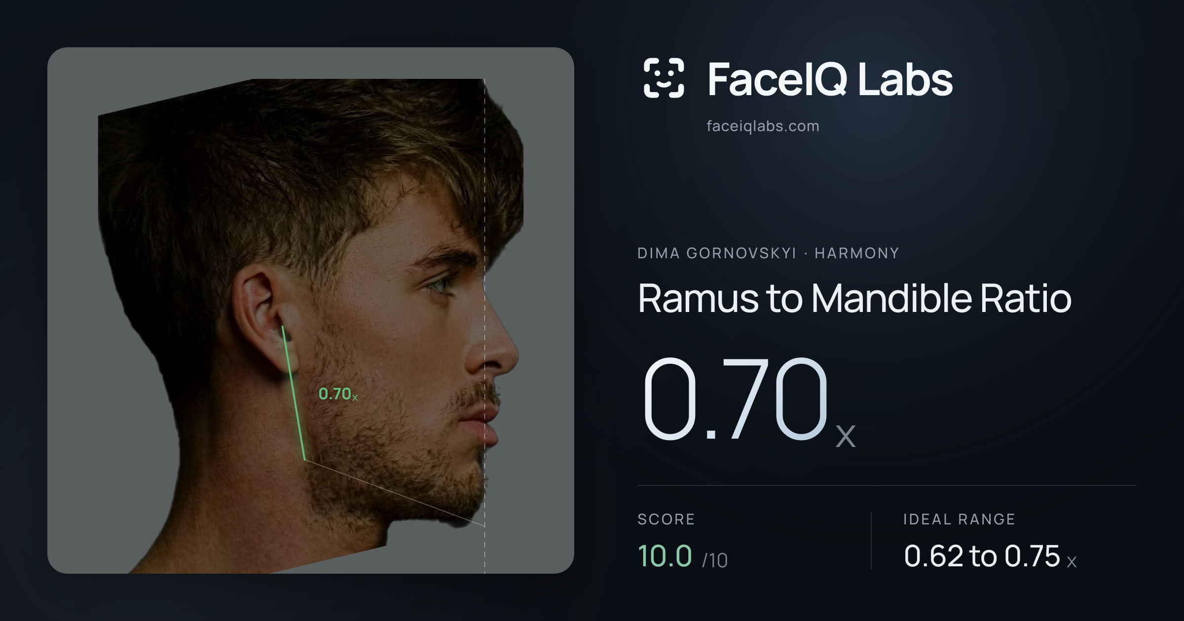 Dima Gornovskyi Ramus to Mandible Ratio: 0.70x, drawn on the photo