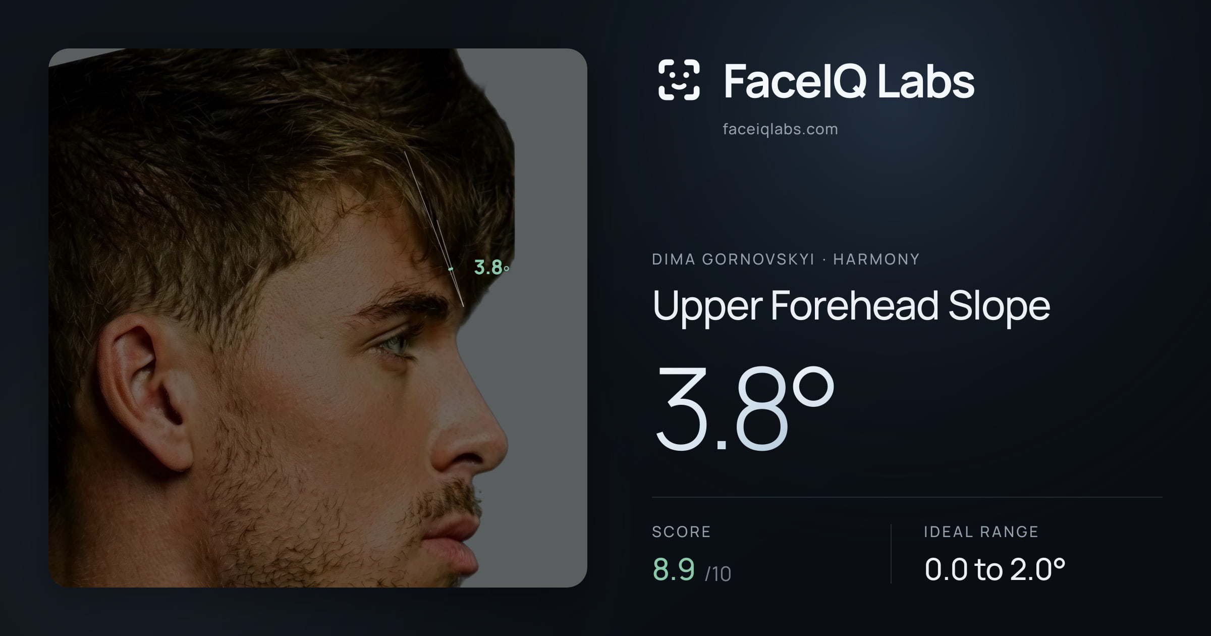 Dima Gornovskyi Upper Forehead Slope: 3.8°, drawn on the photo