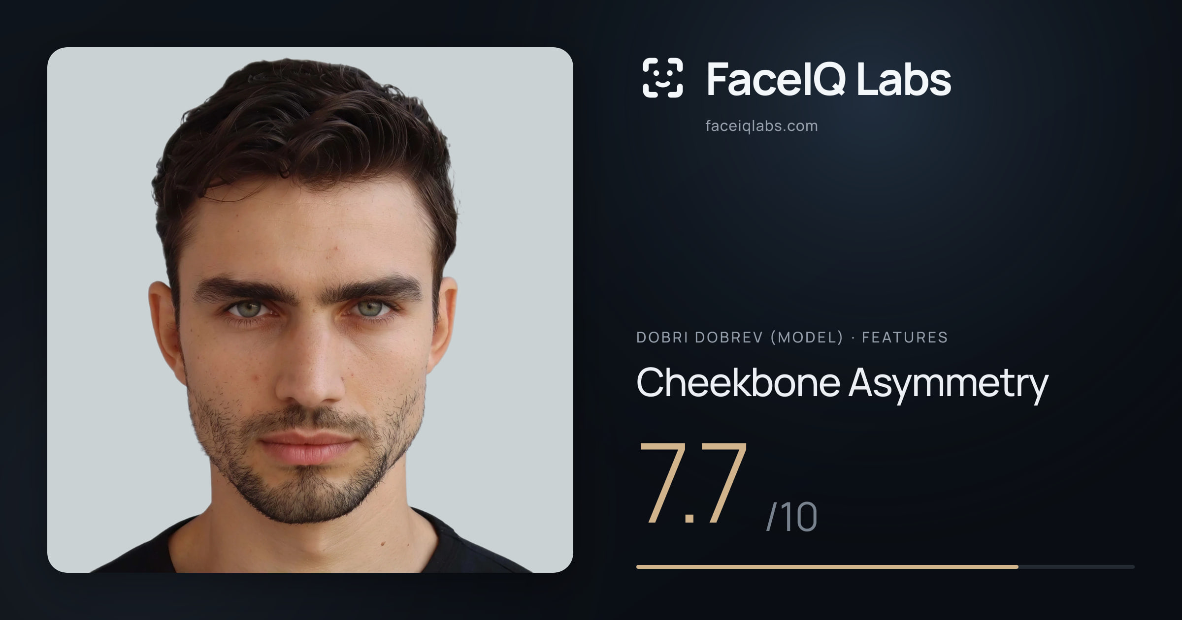 Dobri Dobrev (Model) Cheekbone Asymmetry: 7.7/10, drawn on the photo