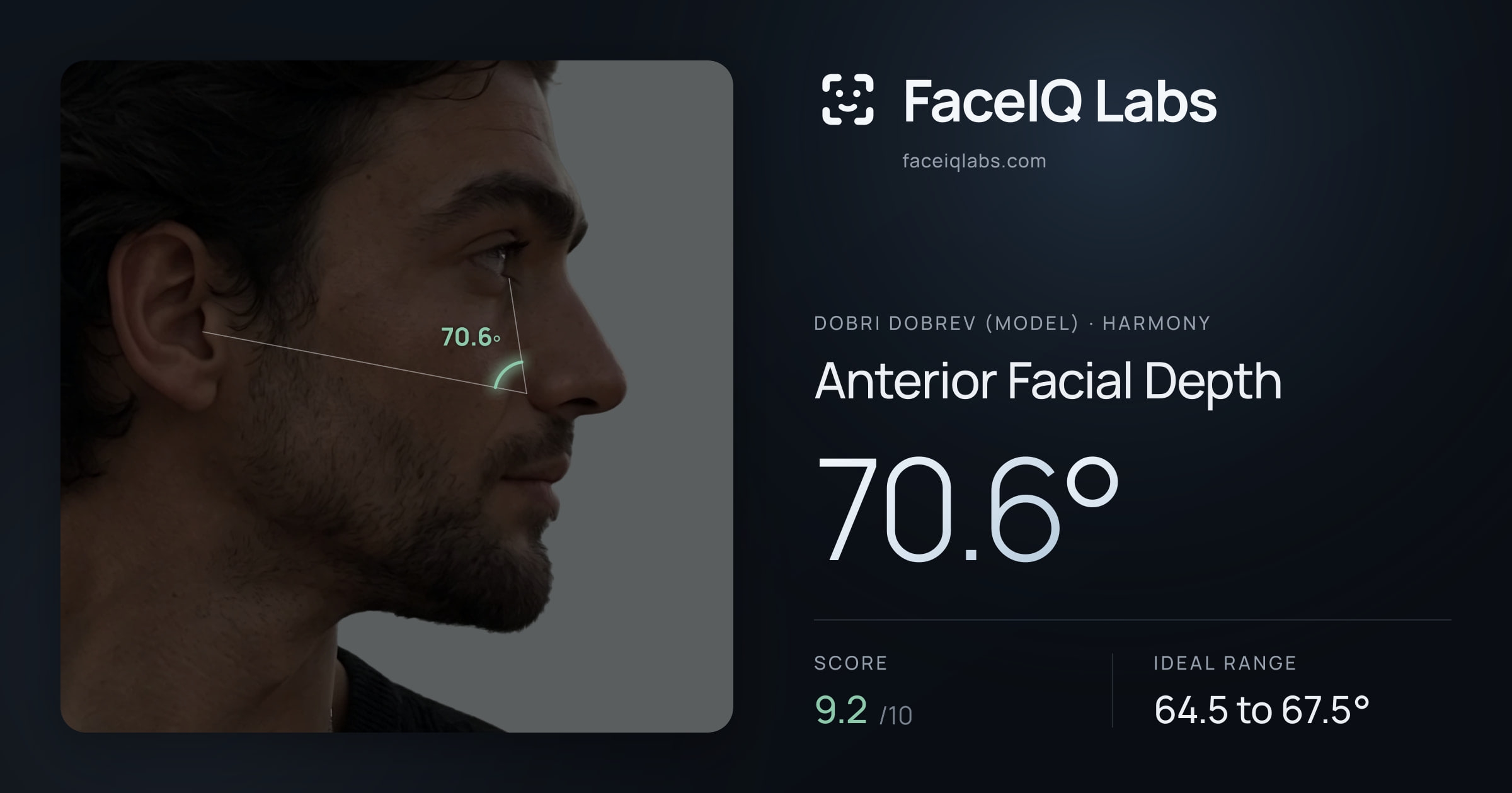 Dobri Dobrev (Model) Anterior Facial Depth: 70.6°, drawn on the photo
