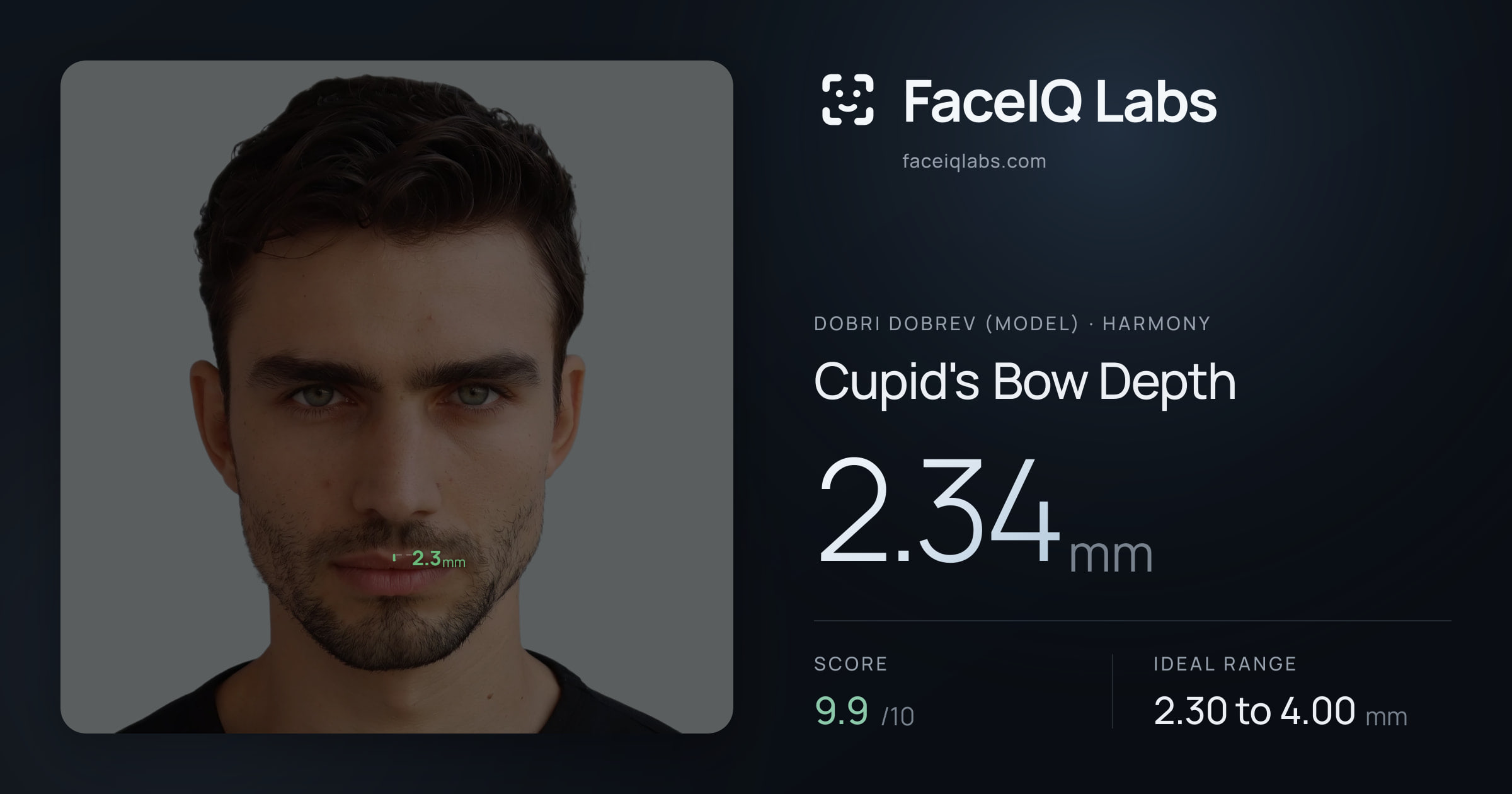 Dobri Dobrev (Model) Cupid's Bow Depth: 2.34mm, drawn on the photo