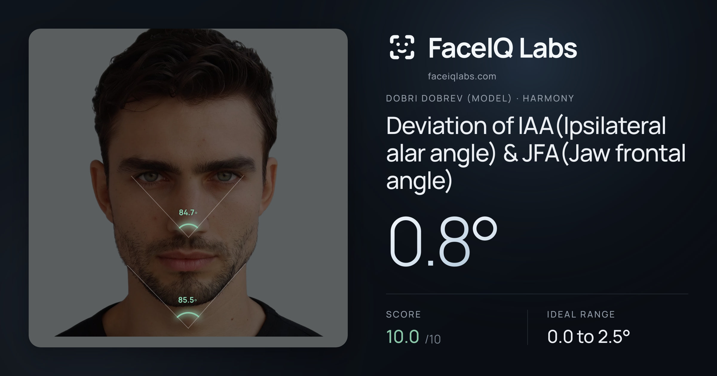 Dobri Dobrev (Model) Deviation of IAA(Ipsilateral alar angle) & JFA(Jaw frontal angle): 0.8°, drawn on the photo