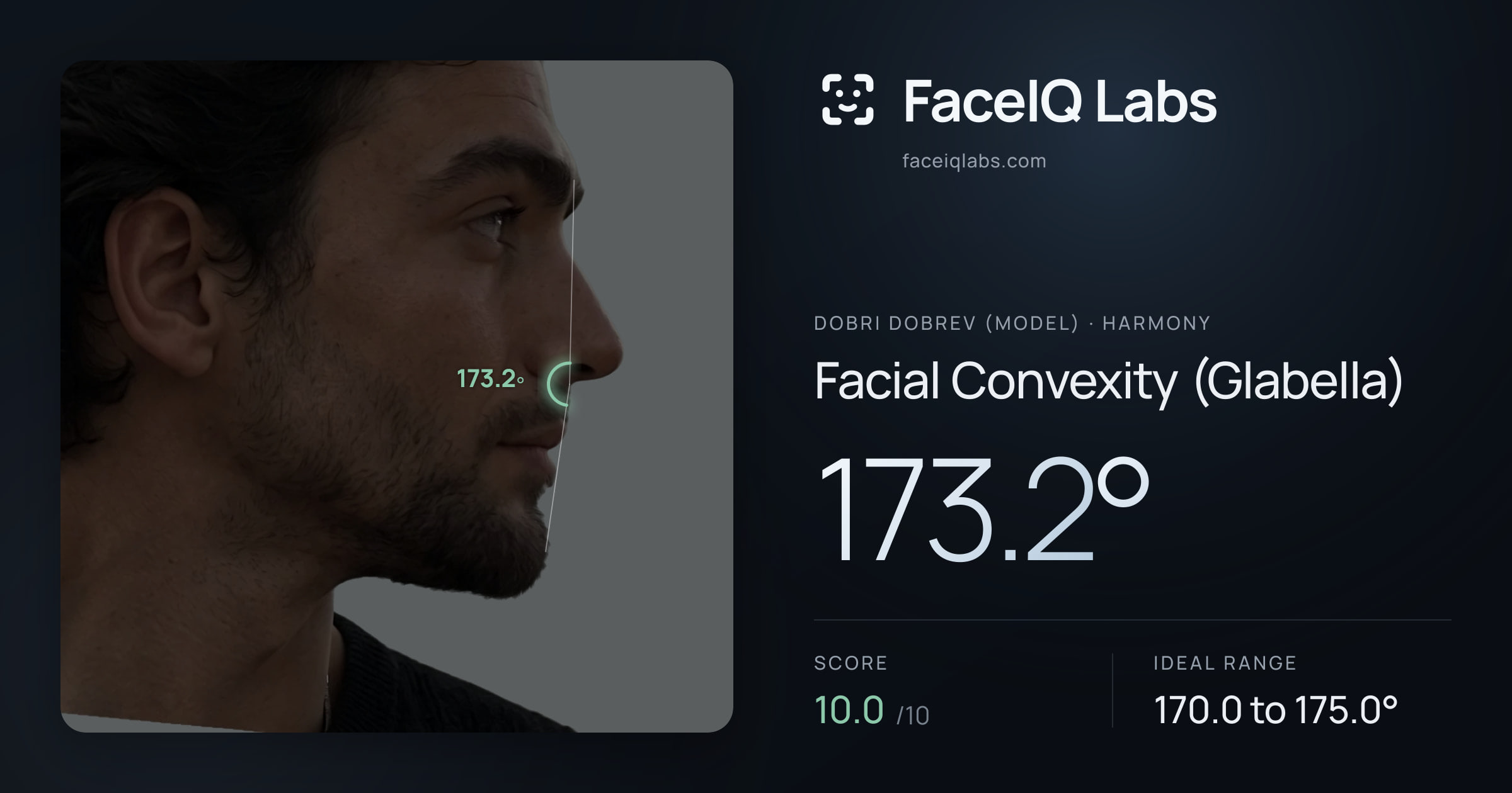 Dobri Dobrev (Model) Facial Convexity (Glabella): 173.2°, drawn on the photo