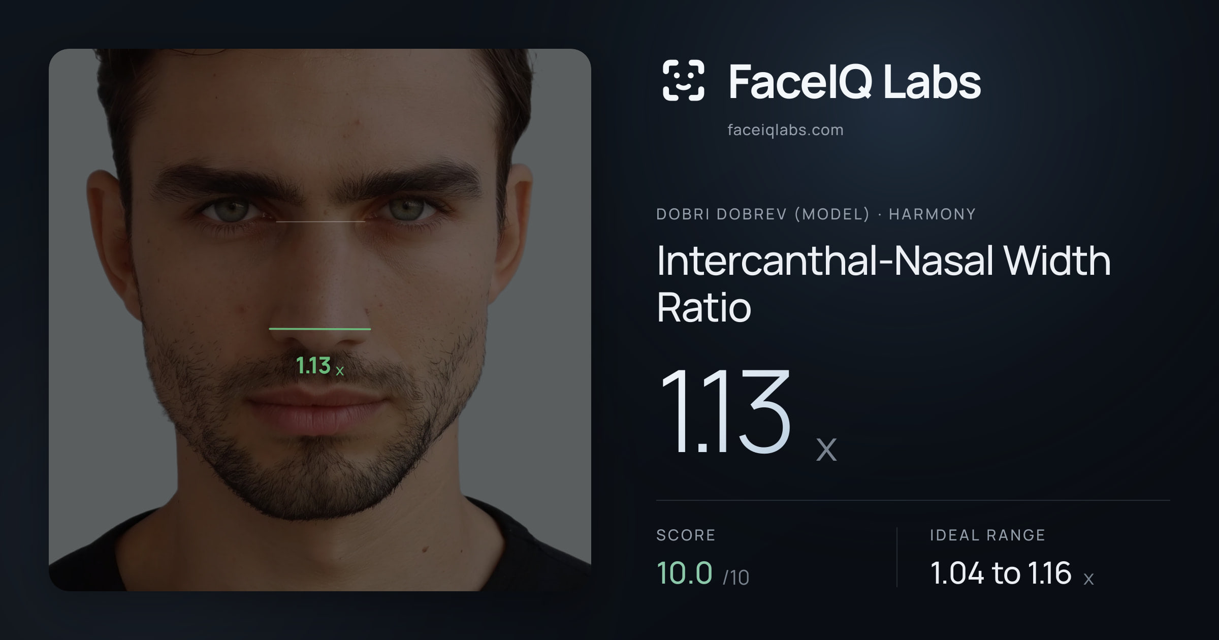 Dobri Dobrev (Model) Intercanthal-Nasal Width Ratio: 1.13x, drawn on the photo