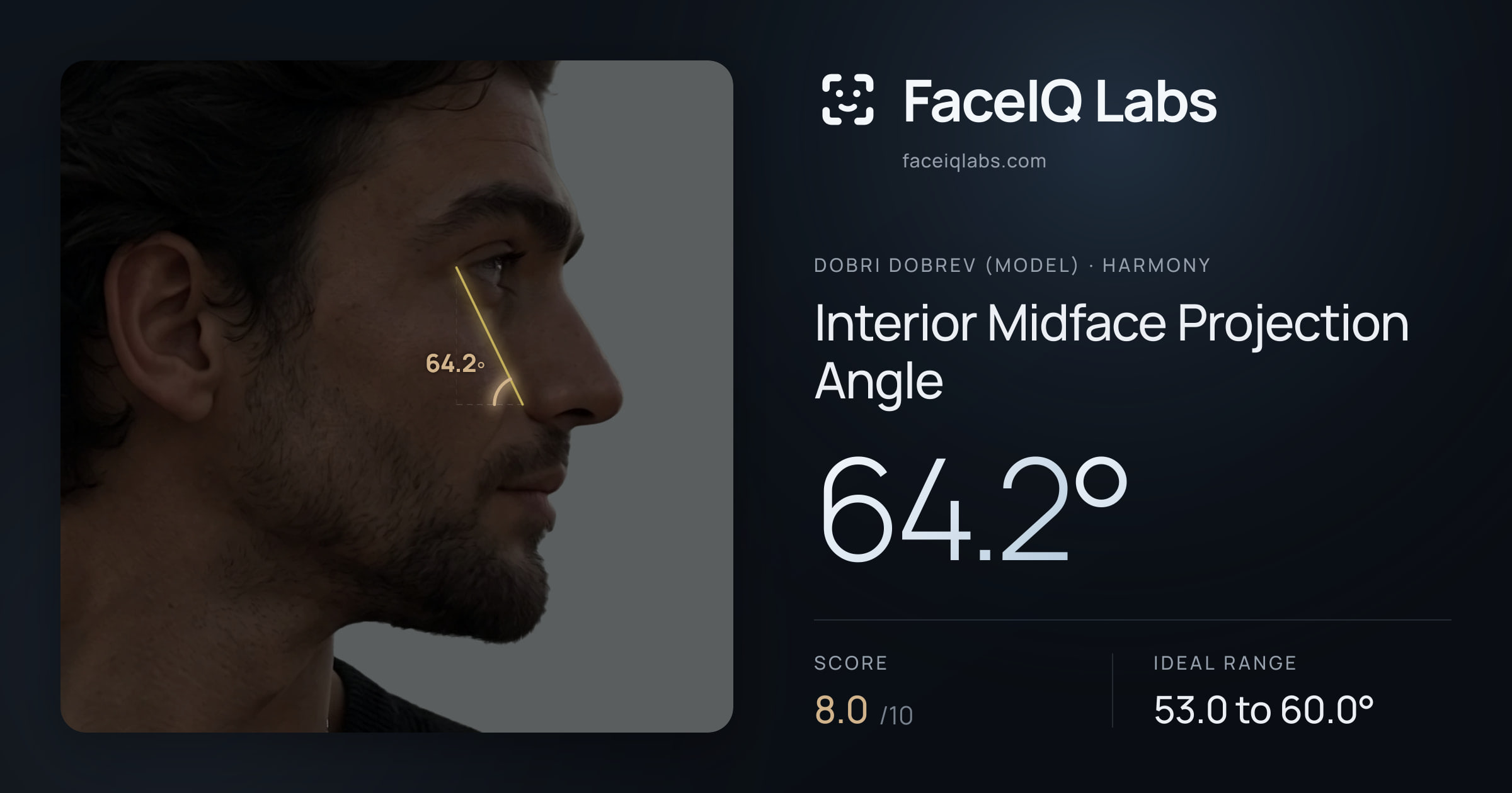 Dobri Dobrev (Model) Interior Midface Projection Angle: 64.2°, drawn on the photo