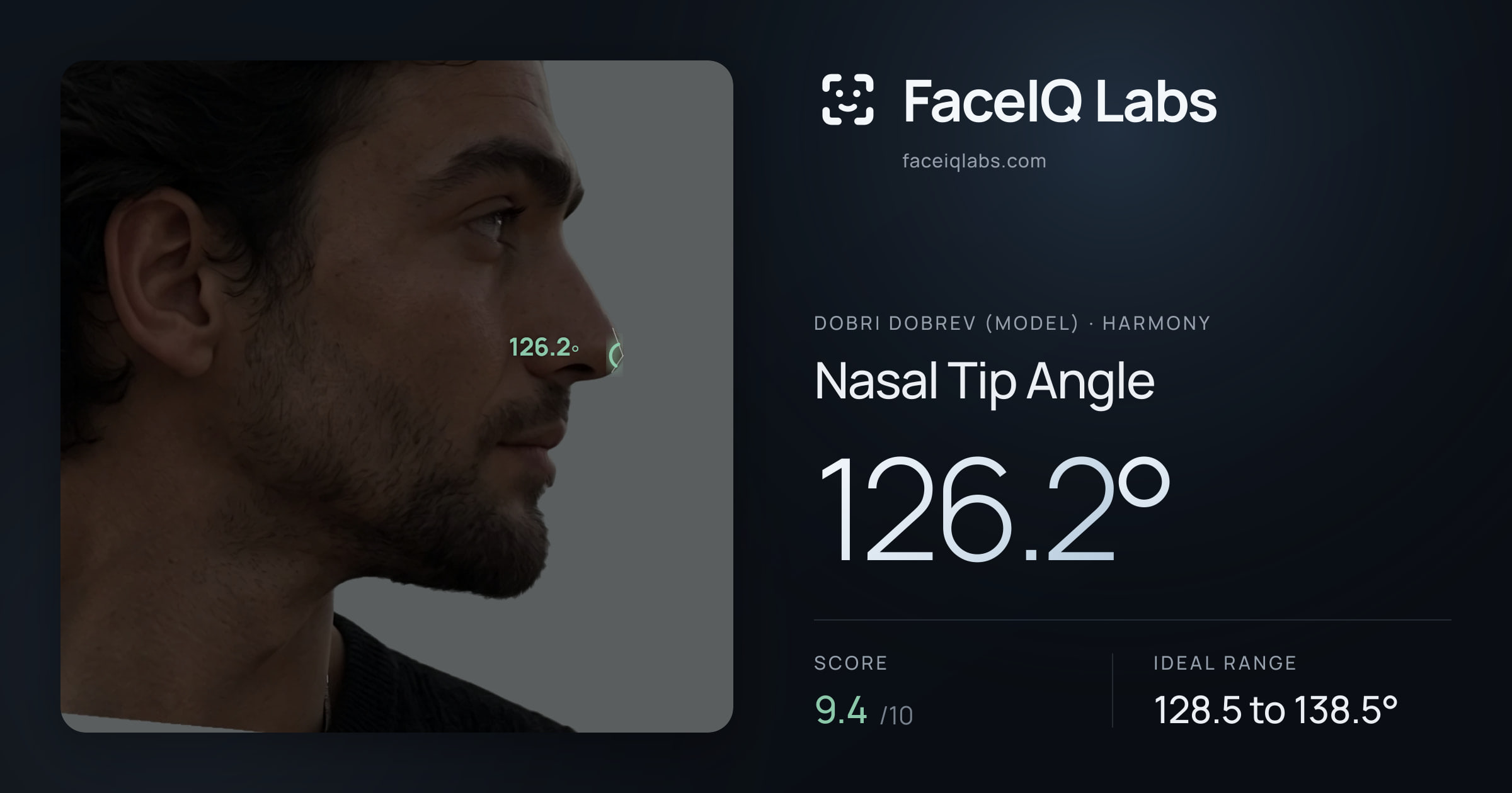 Dobri Dobrev (Model) Nasal Tip Angle: 126.2°, drawn on the photo